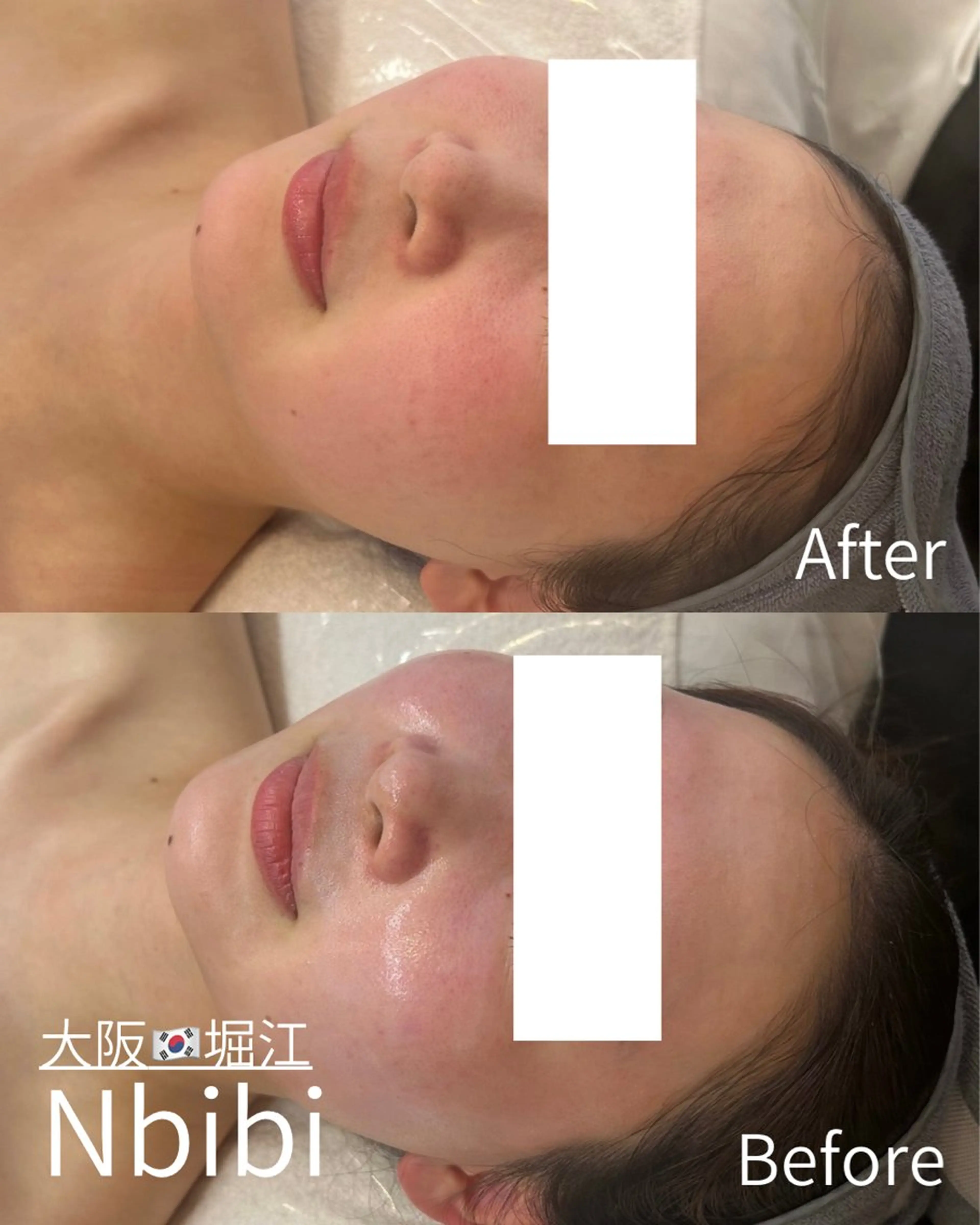 エステ 韓国🇰🇷価格 サロン_Nbibiの眉毛・アイブロウイメージ