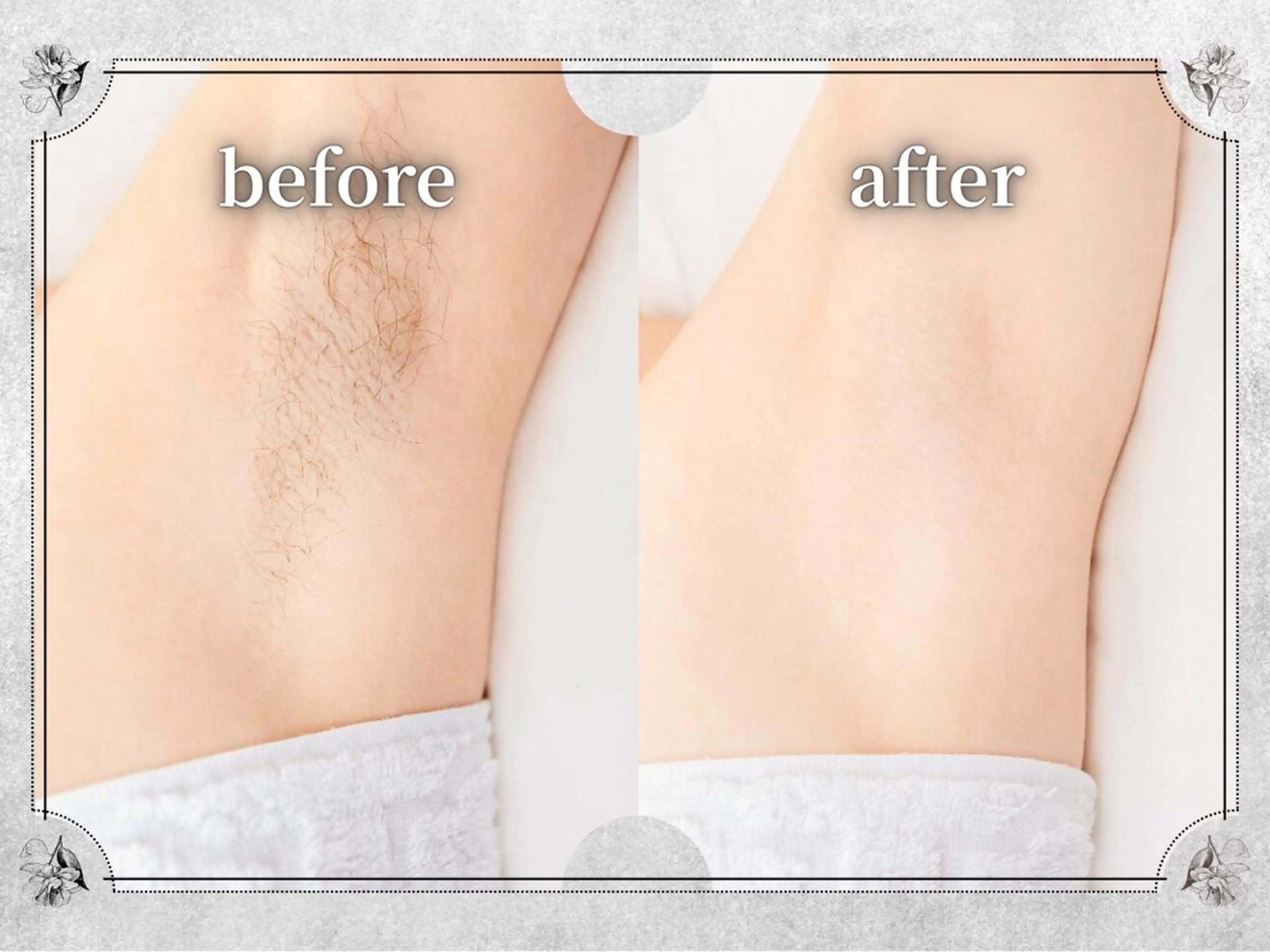 都度払い 脱毛 Lino柏/moeのエステ・リラクイメージ