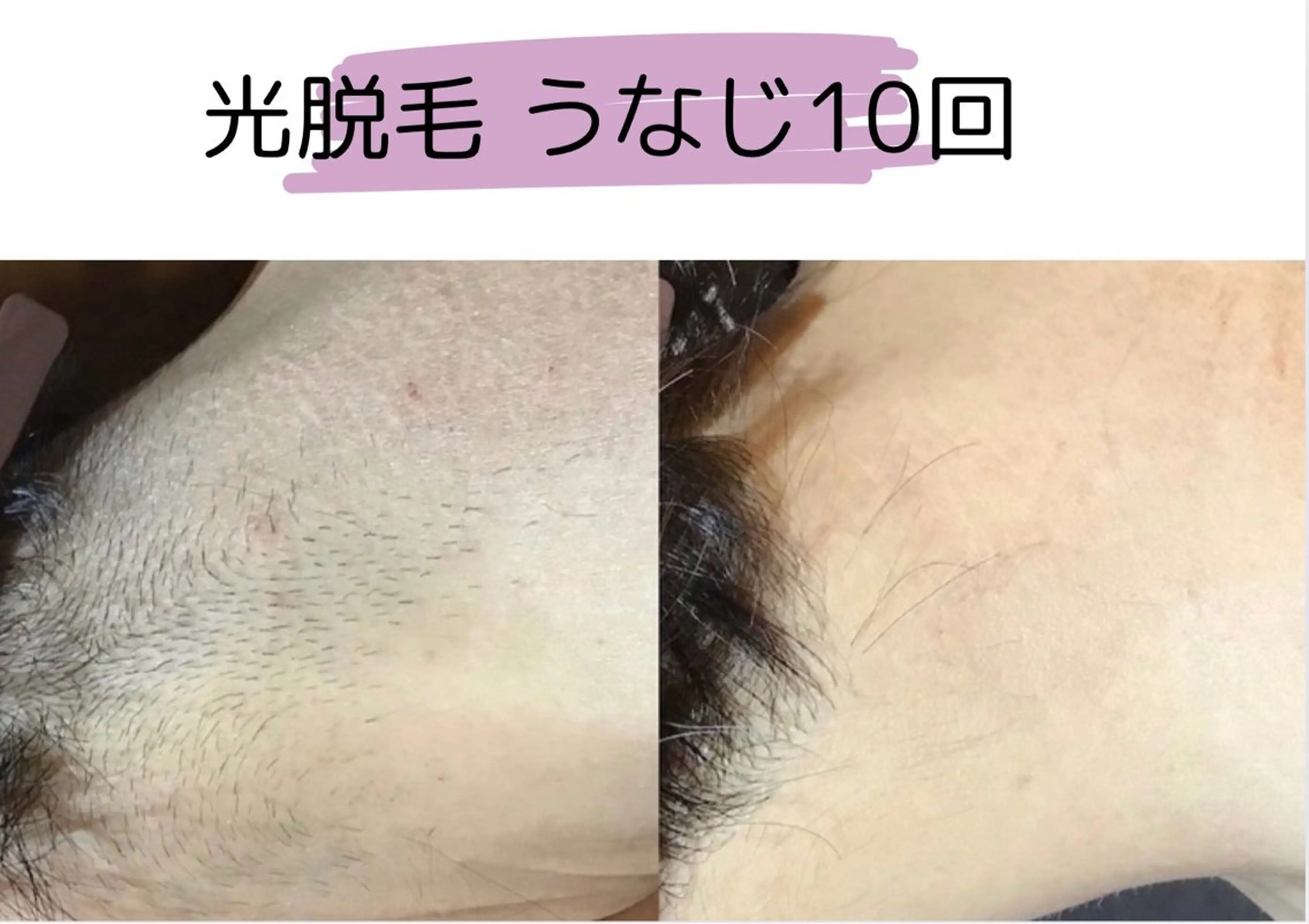 TRINTE 酒井のエステ・リラクイメージ