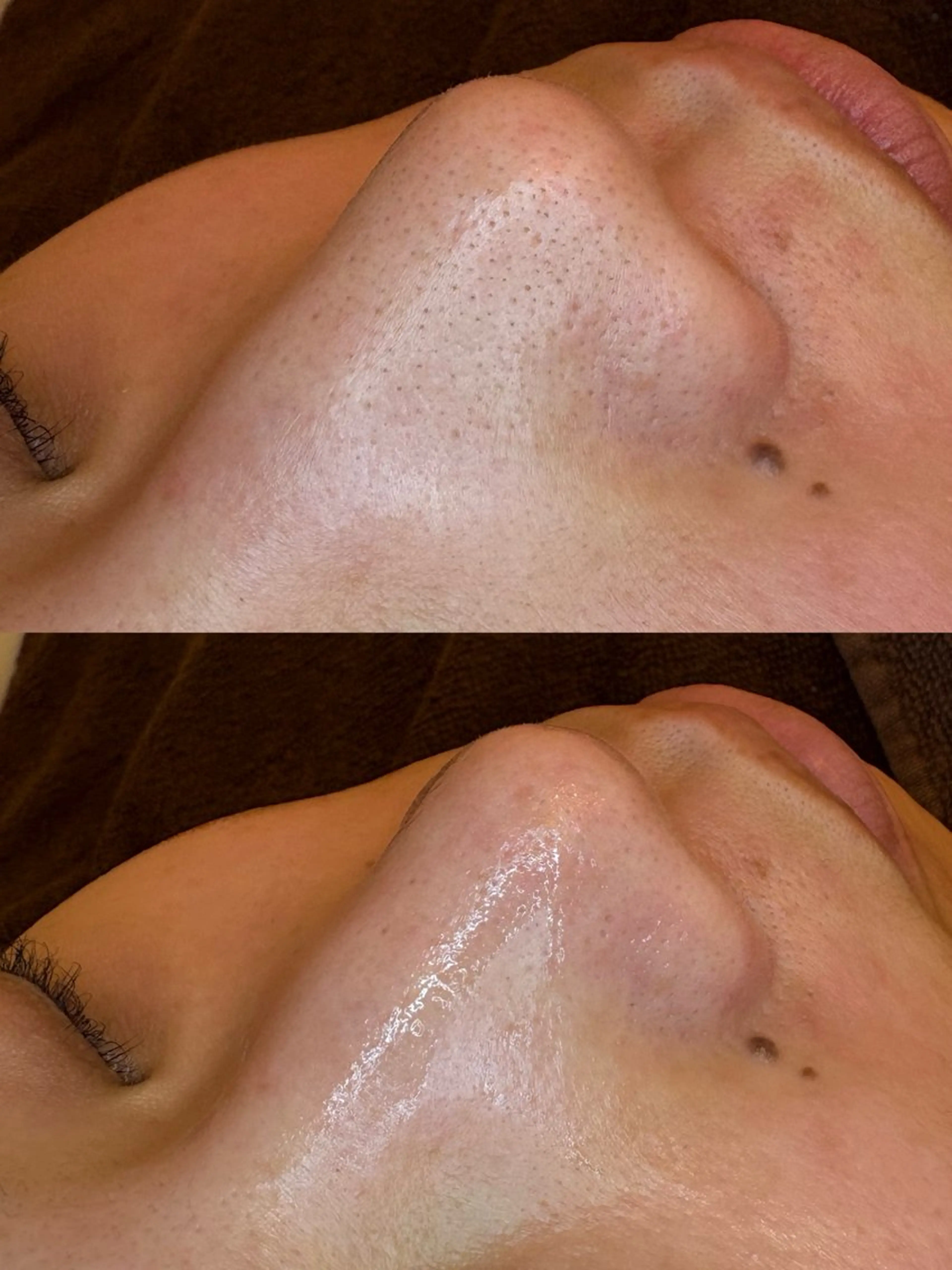 🤍アベシュリ /フェイシャル🤍のエステ・リラクイメージ