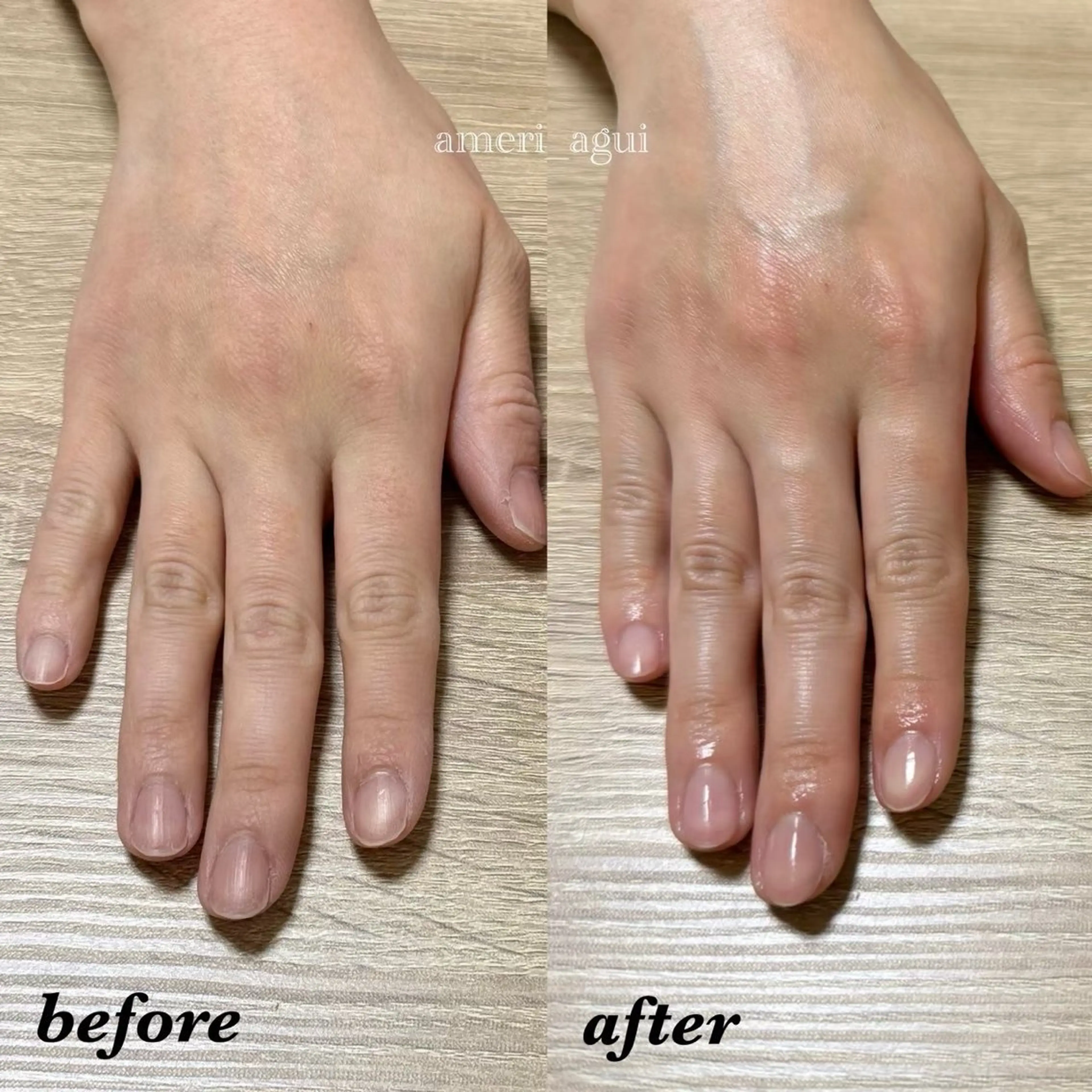 ハンドケアの写真