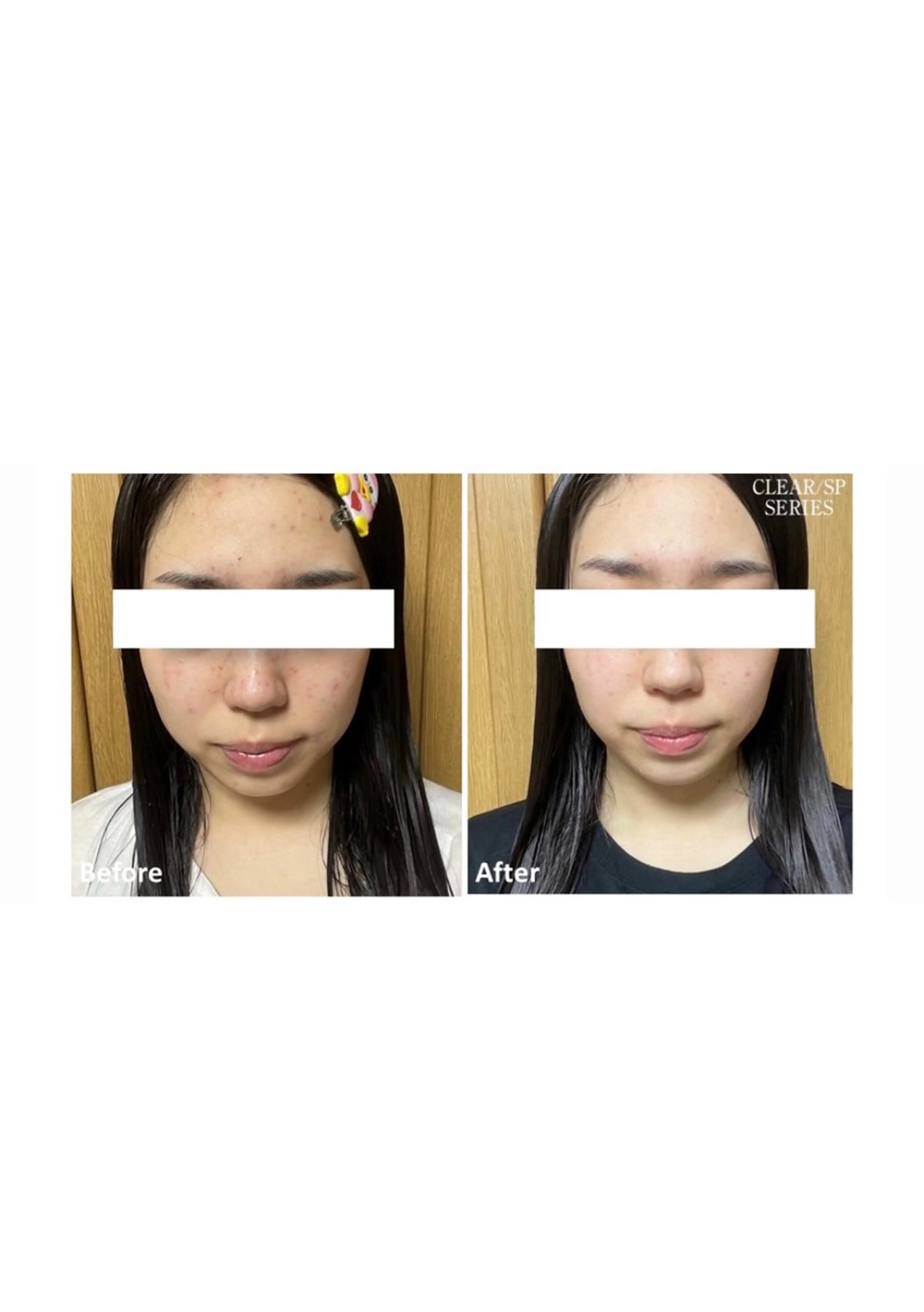 エステ はばすみれ🎀ﾈｲﾙ 光ﾌｪｲｼｬﾙ ﾍｱのネイルデザイン
