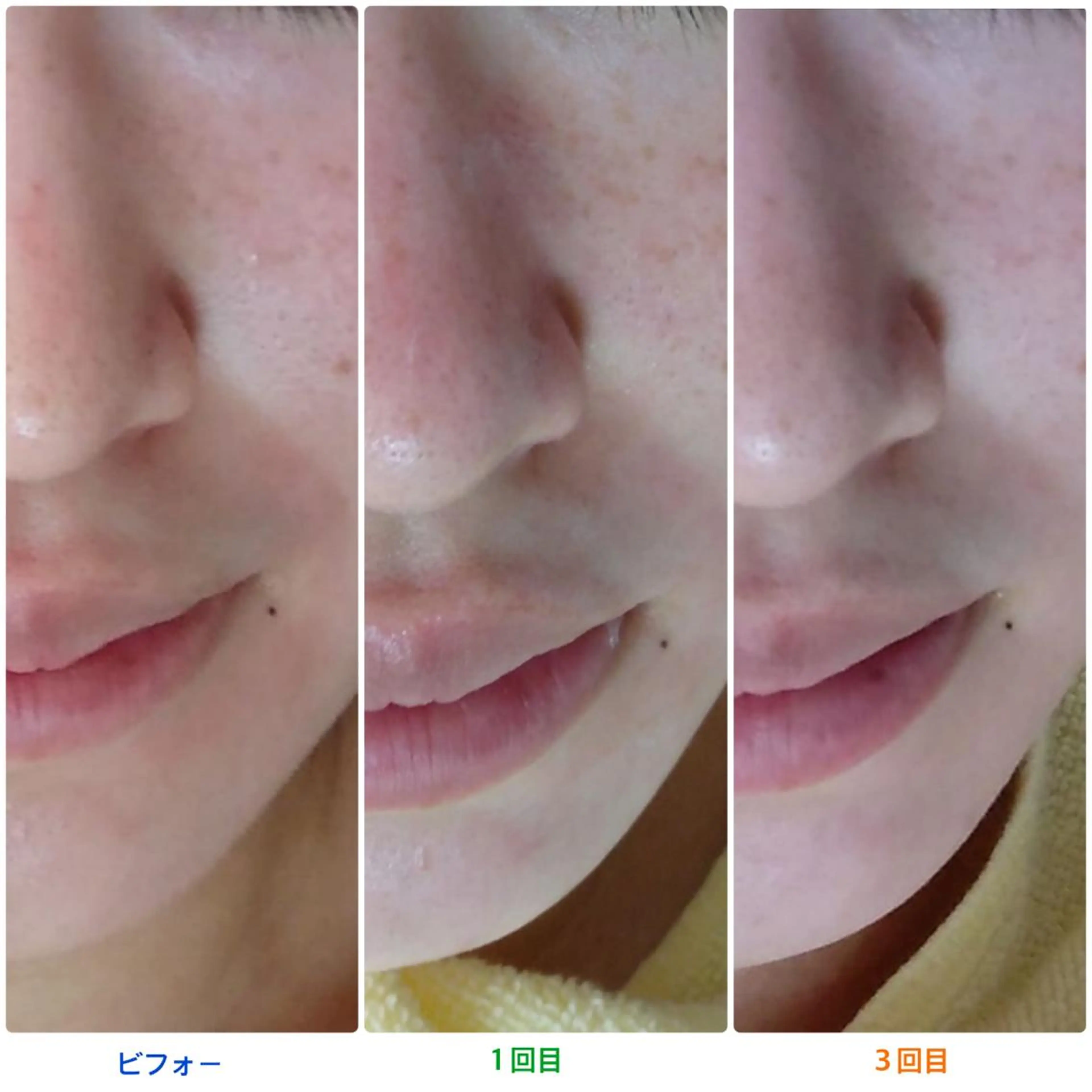 エステ 長谷井 敬子のエステ・リラクイメージ