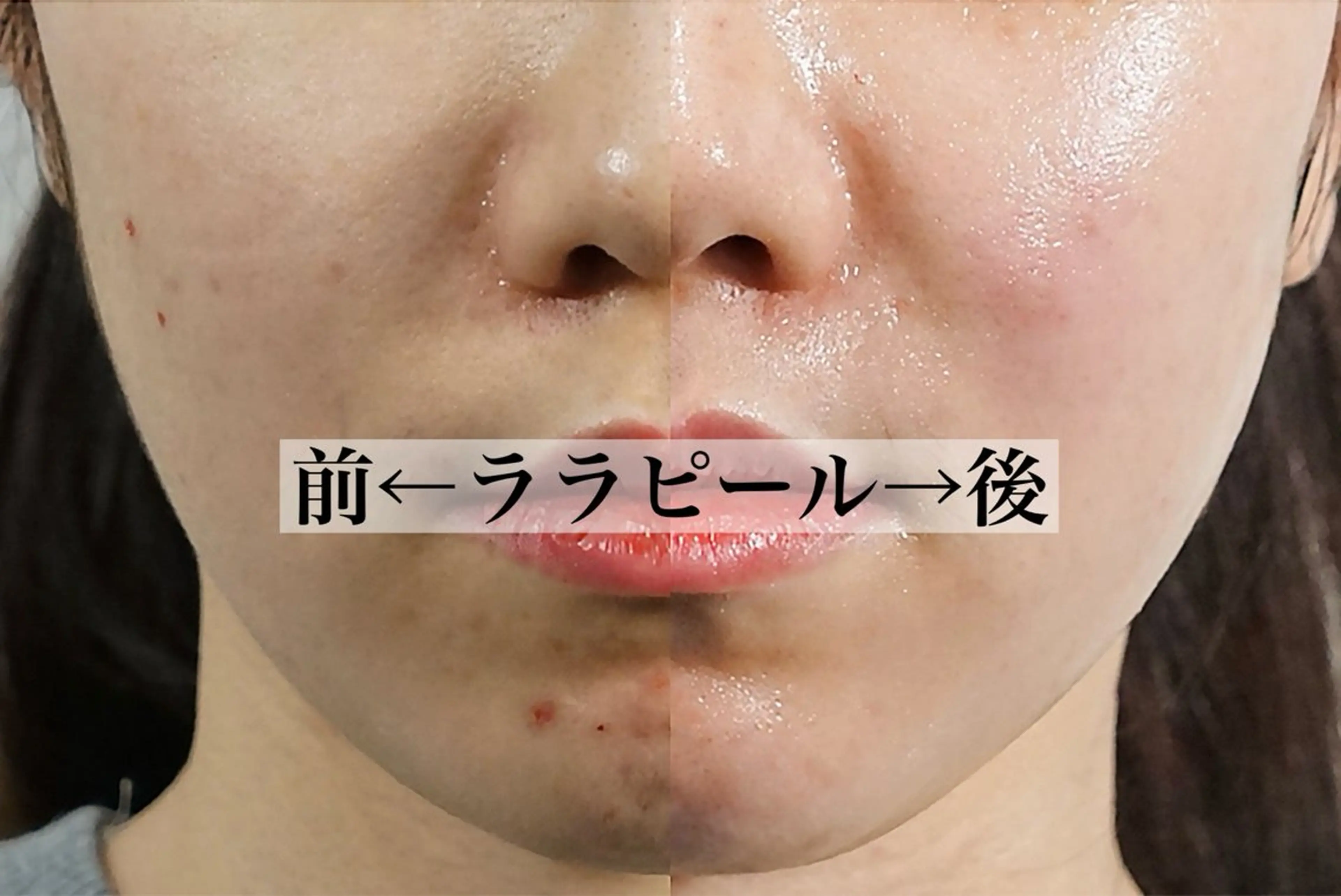 リンパ×ハーブ蒸し TIARA.烏丸三条のエステ・リラクイメージ