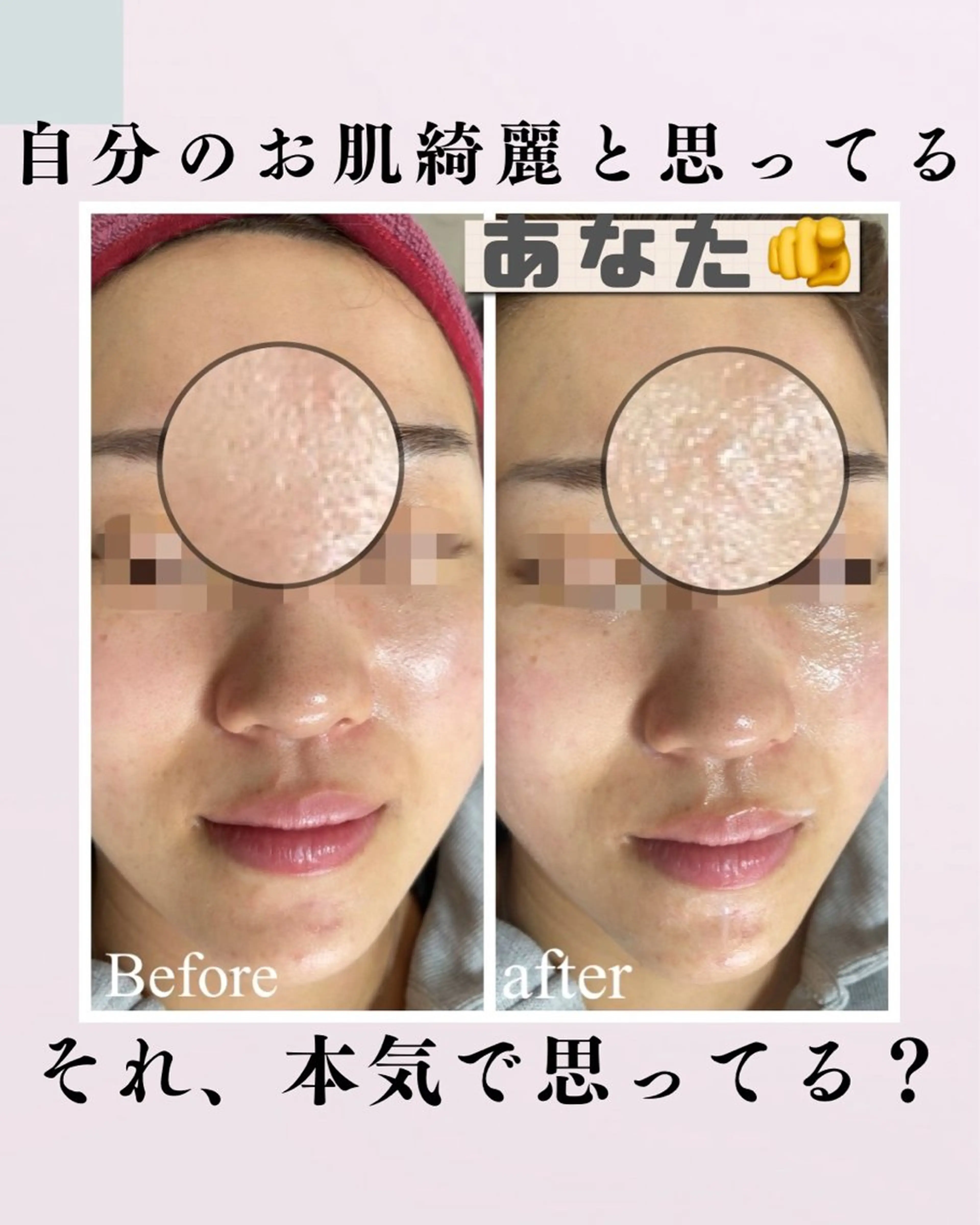肌質改善サロン facialmoonのエステ・リラクイメージ