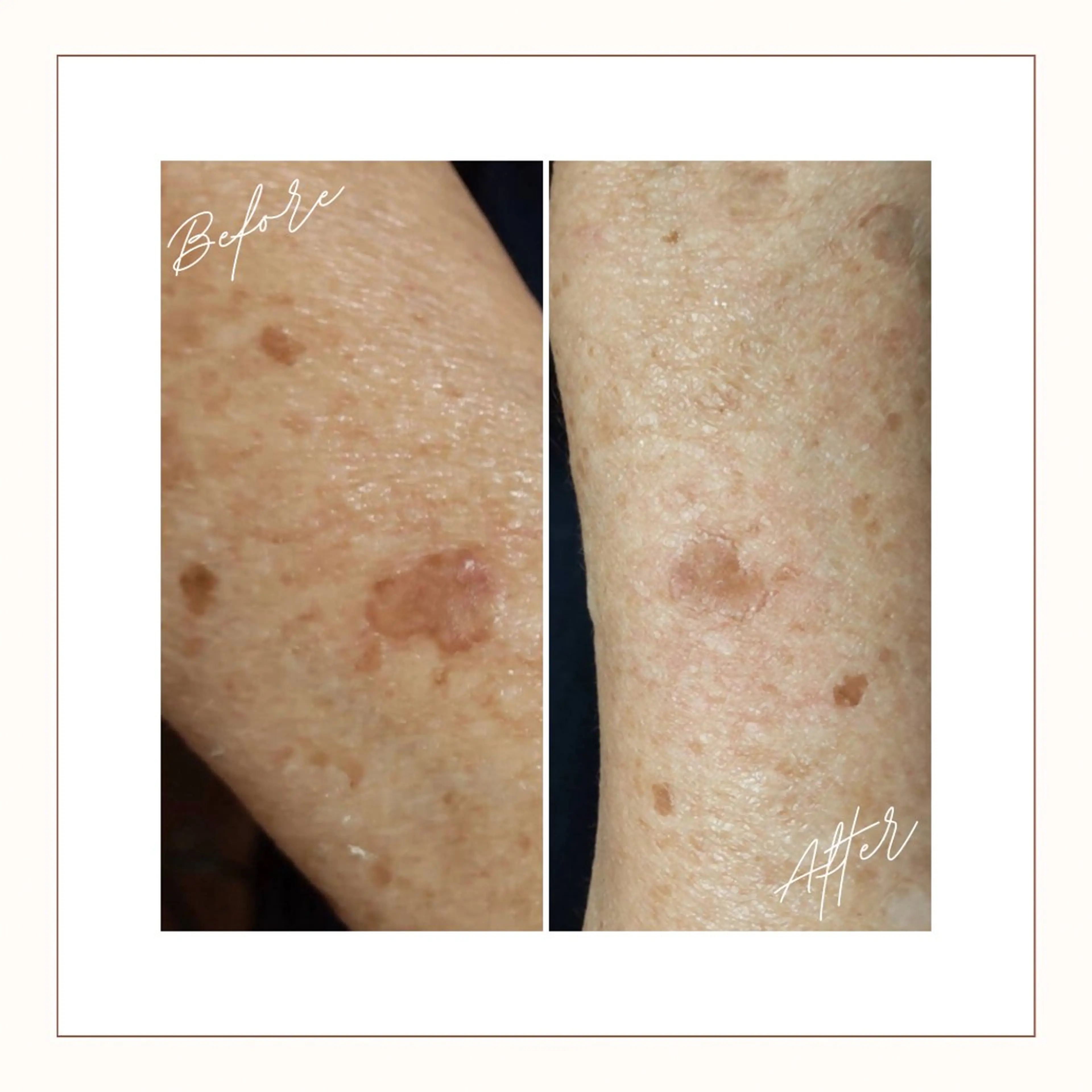 ヌーベル プリュムのその他イメージ