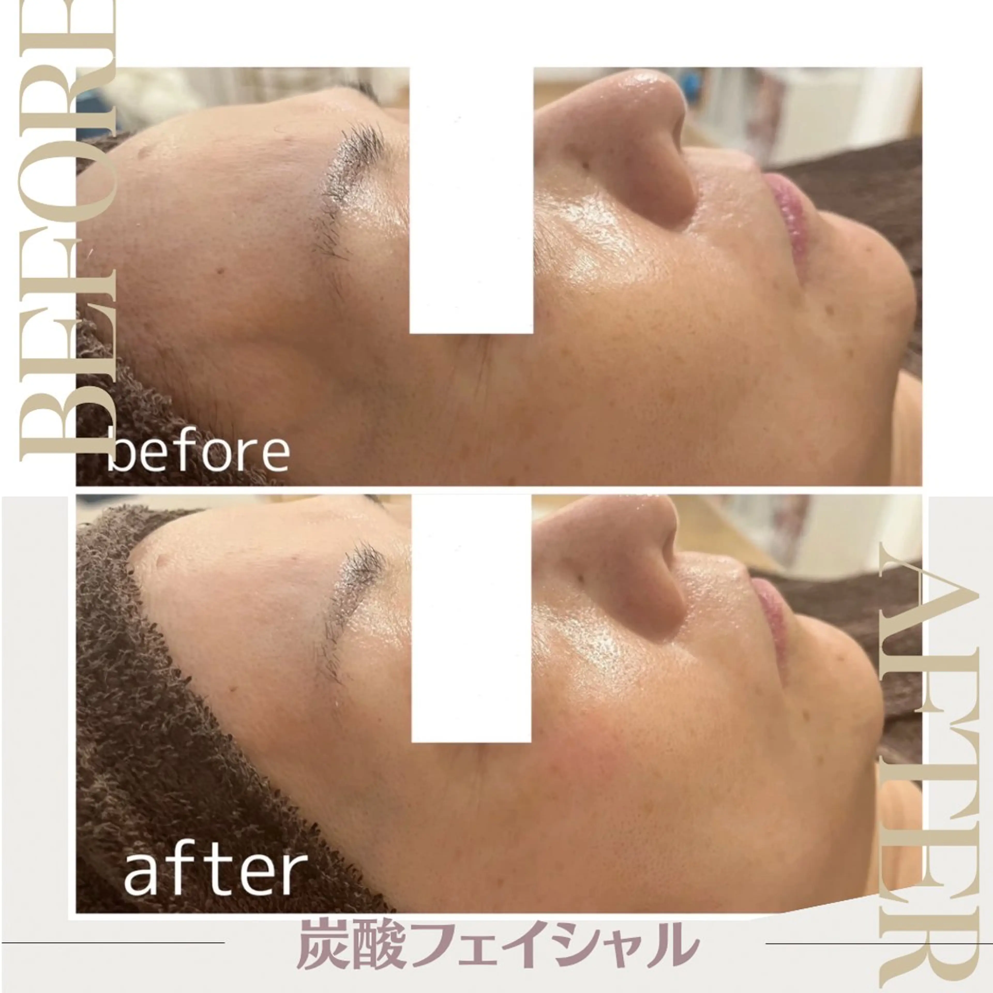 エステサロン シェリーのエステ・リラクイメージ