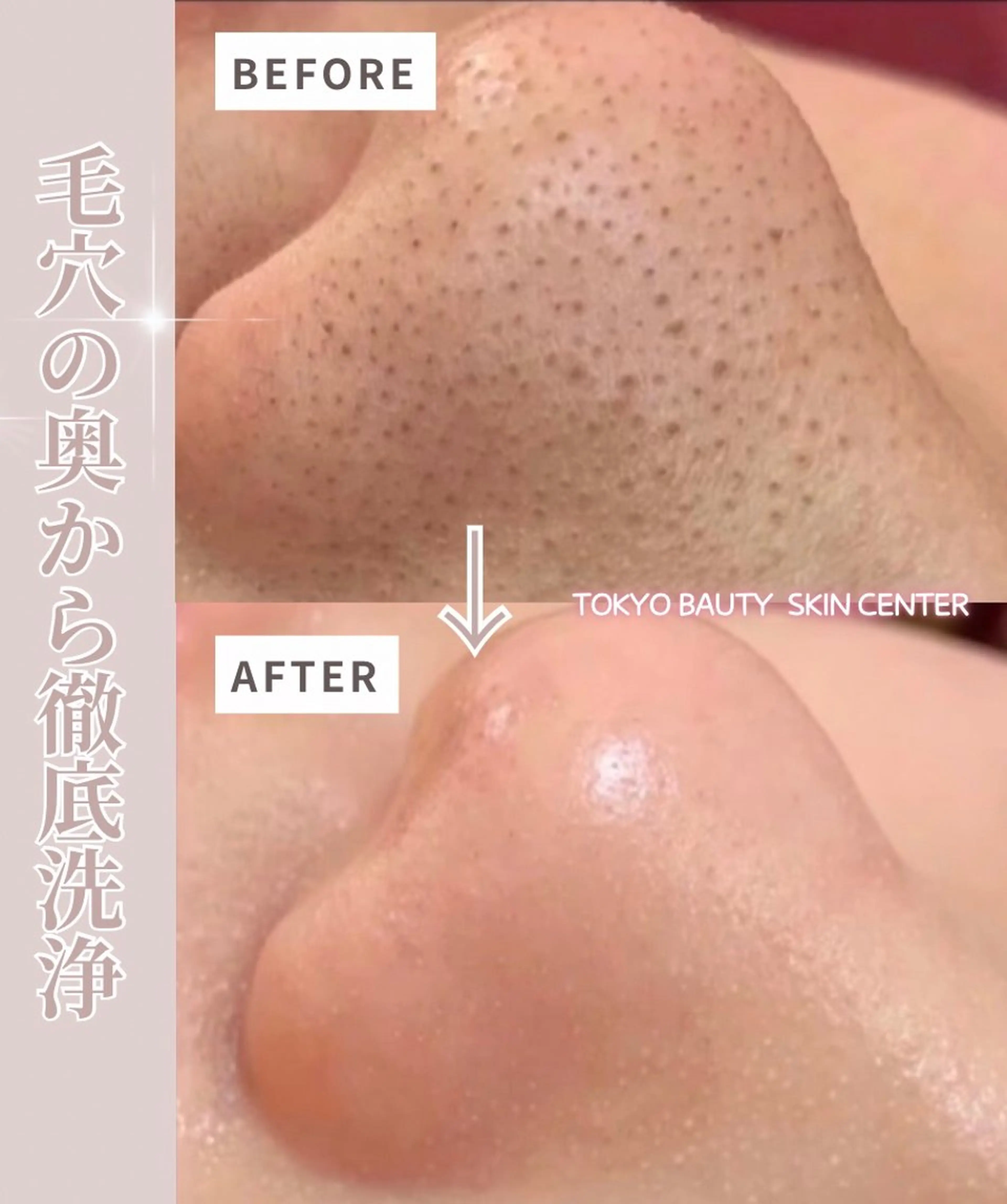 エステ リラク 韓国肌管理& ワックス脱毛のエステ・リラクイメージ