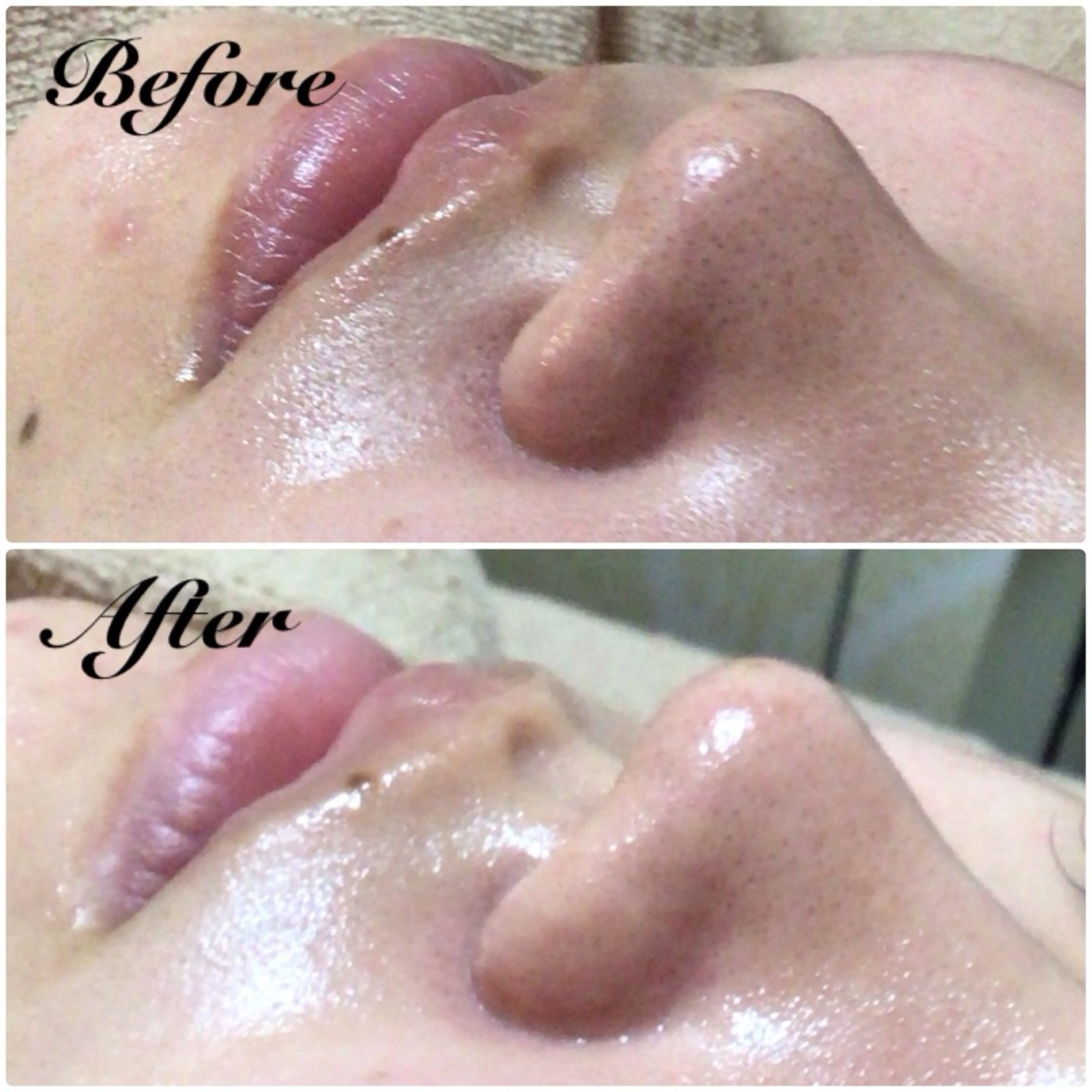 毛穴専門店 アフロディーテのエステ・リラクイメージ