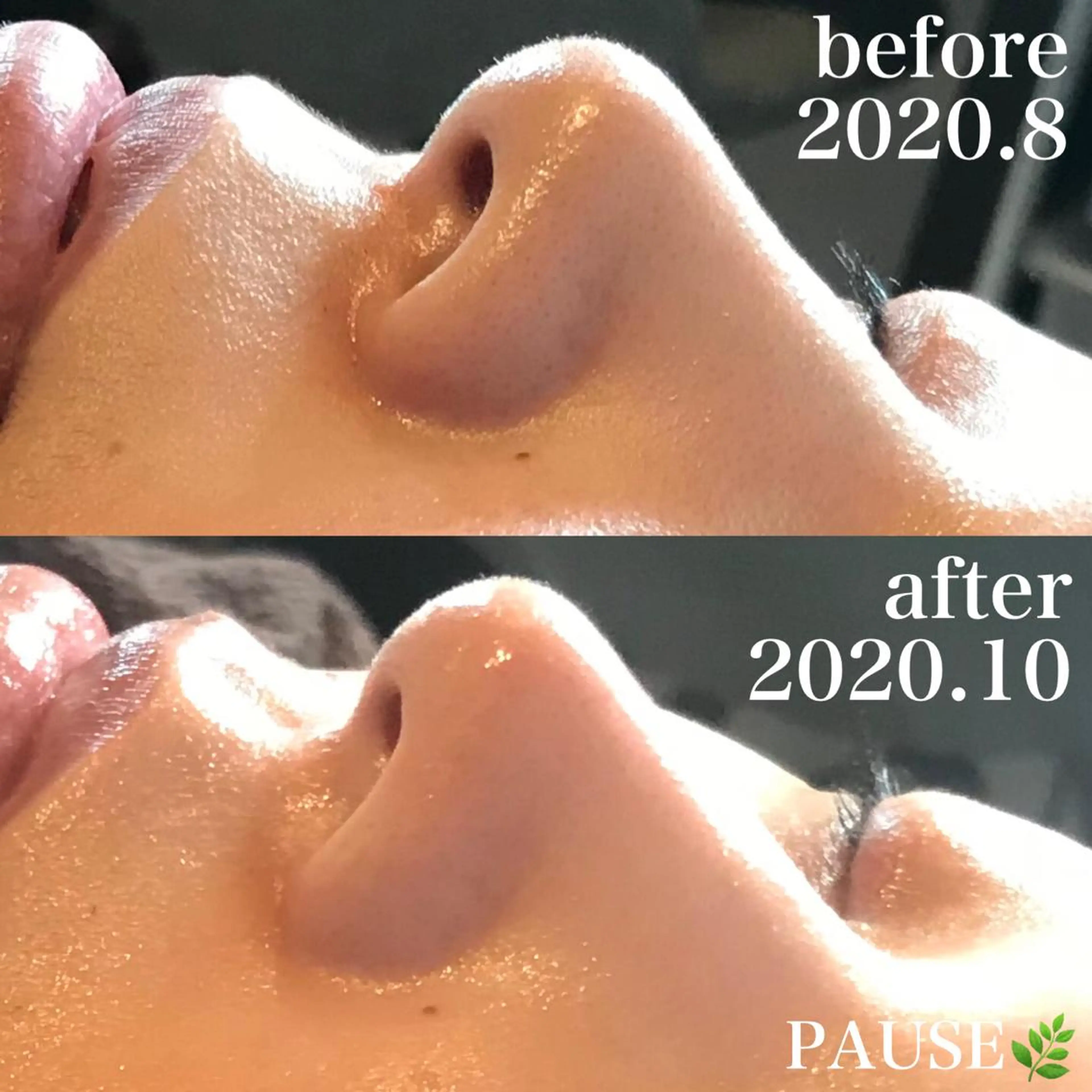 エステ 浜野 恵美のエステ・リラクイメージ