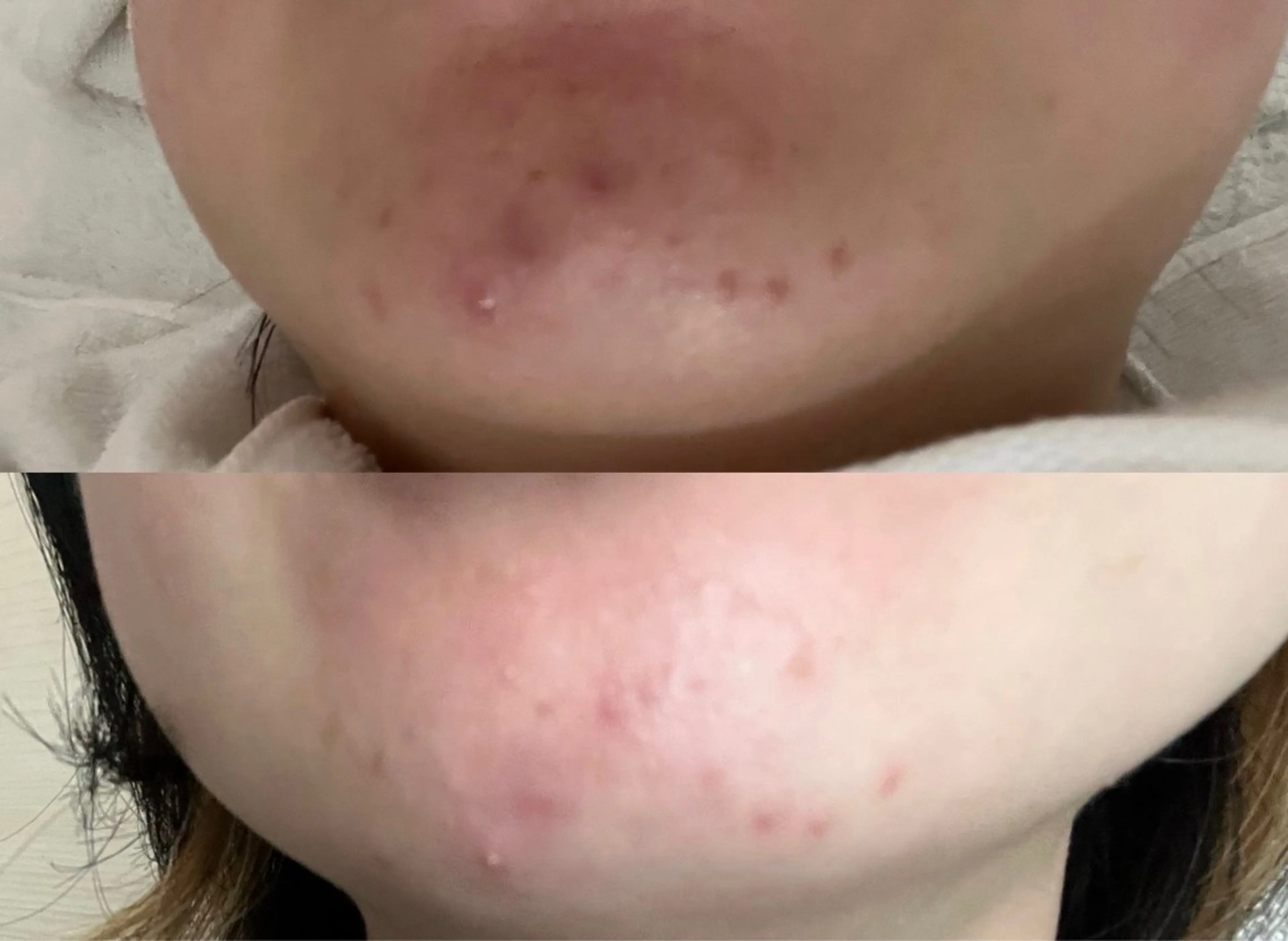 エステ リラク 中井 小春のエステ・リラクイメージ