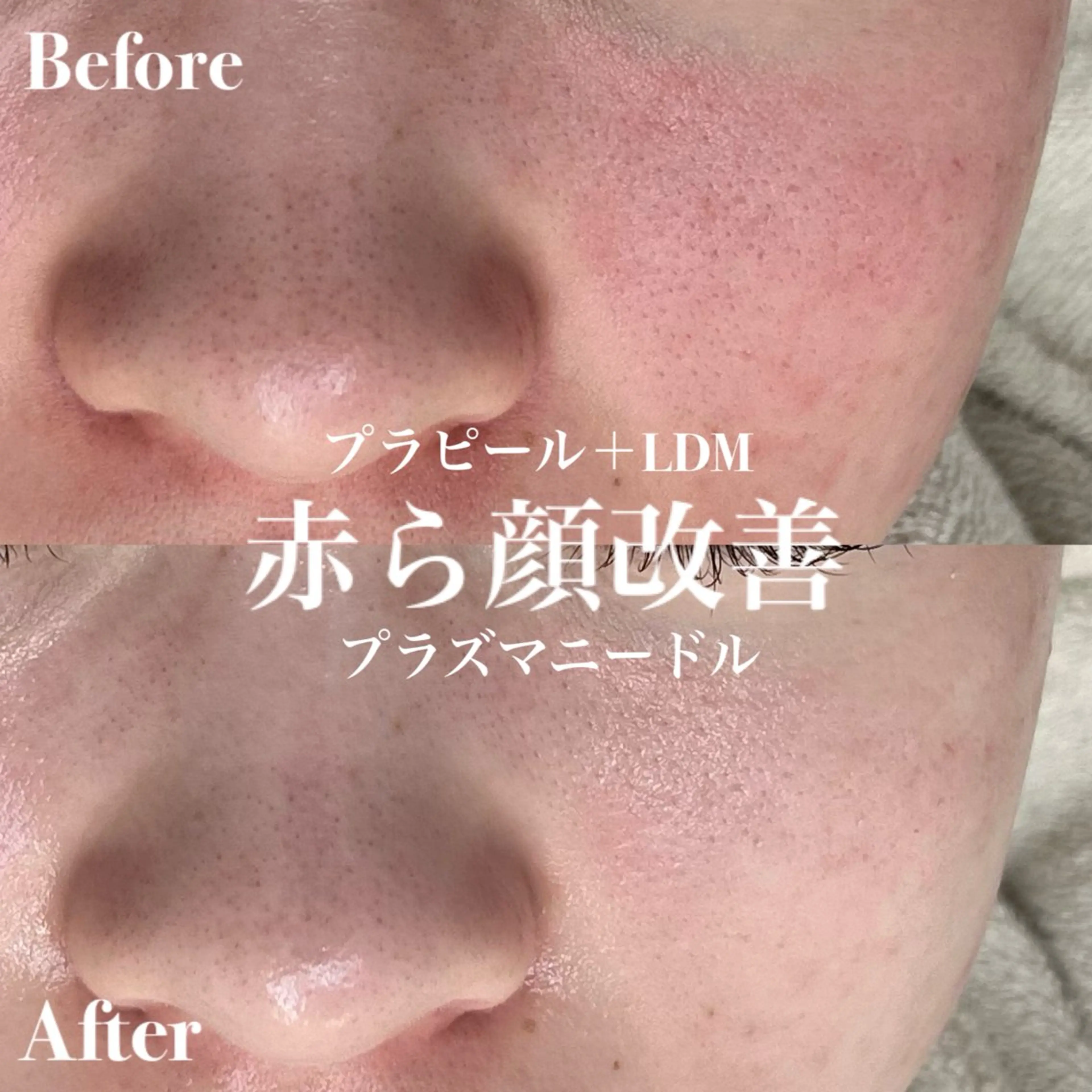 韓国肌管理&小顔 ＩＲＯＨＡのエステ・リラクイメージ