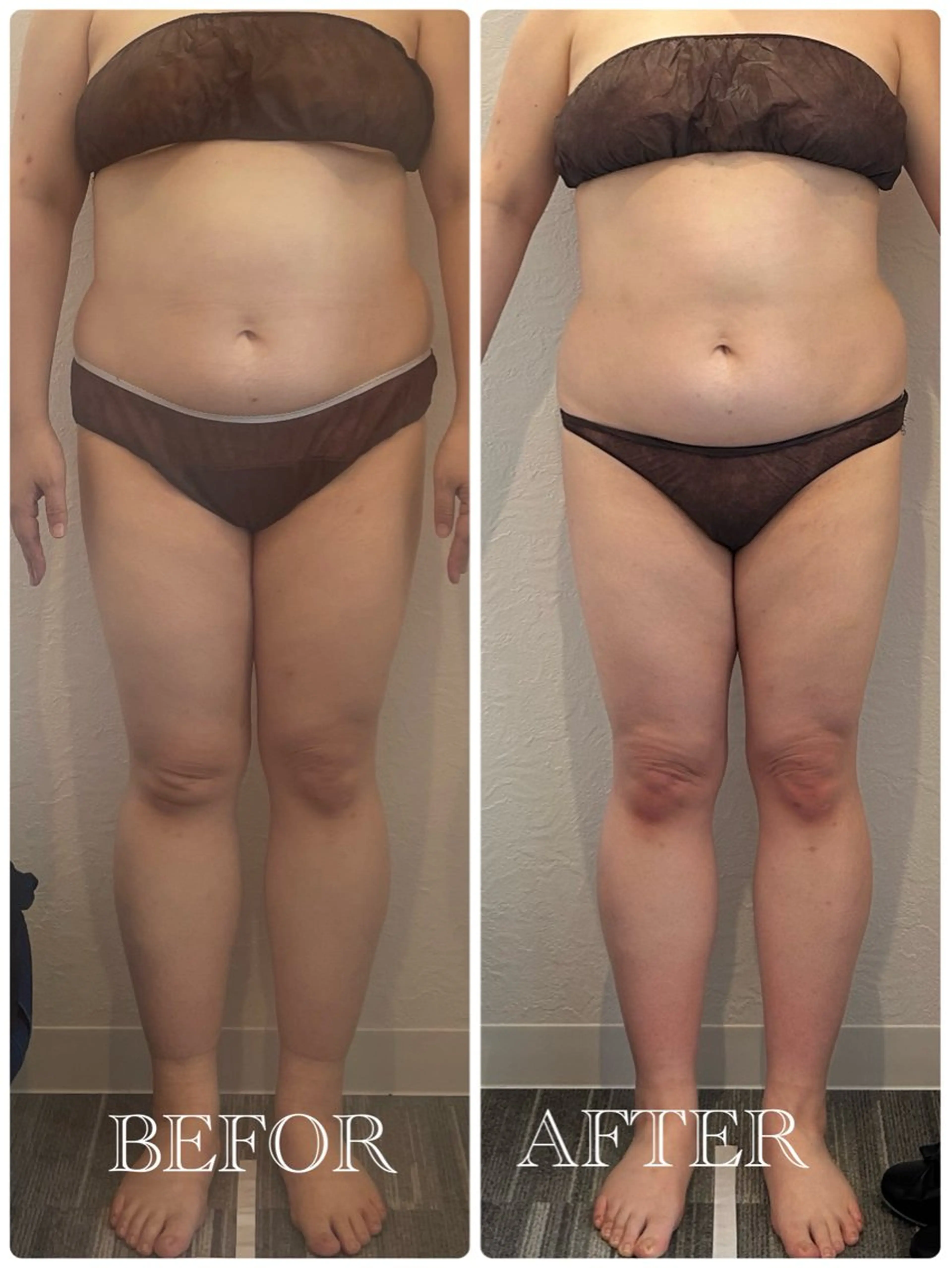 当日限定クーポン5/19(日) 痩身　半身プラン(上半身or下半身)の写真