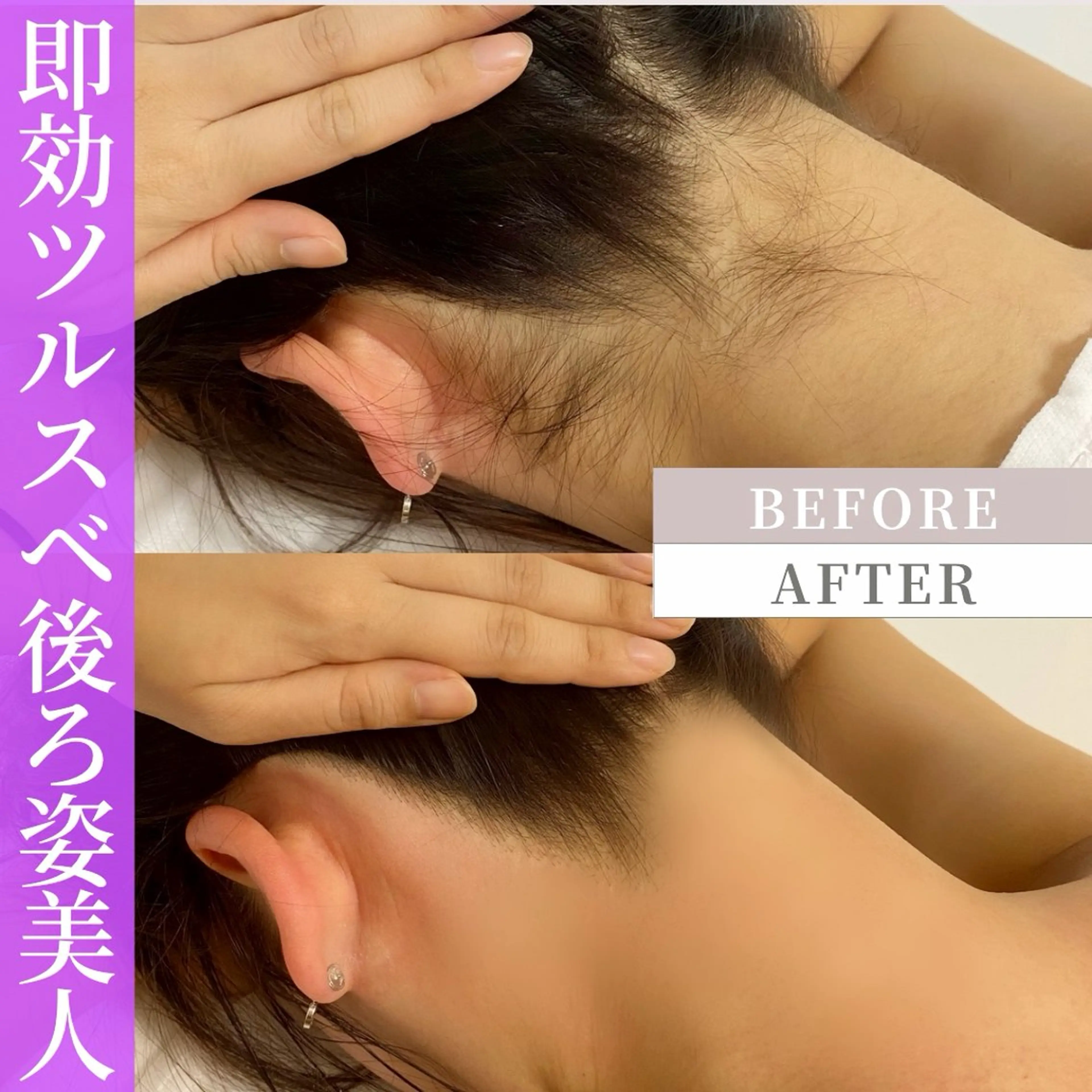 脱毛 シュガーリング脱毛 専門店Ranunのエステ・リラクイメージ