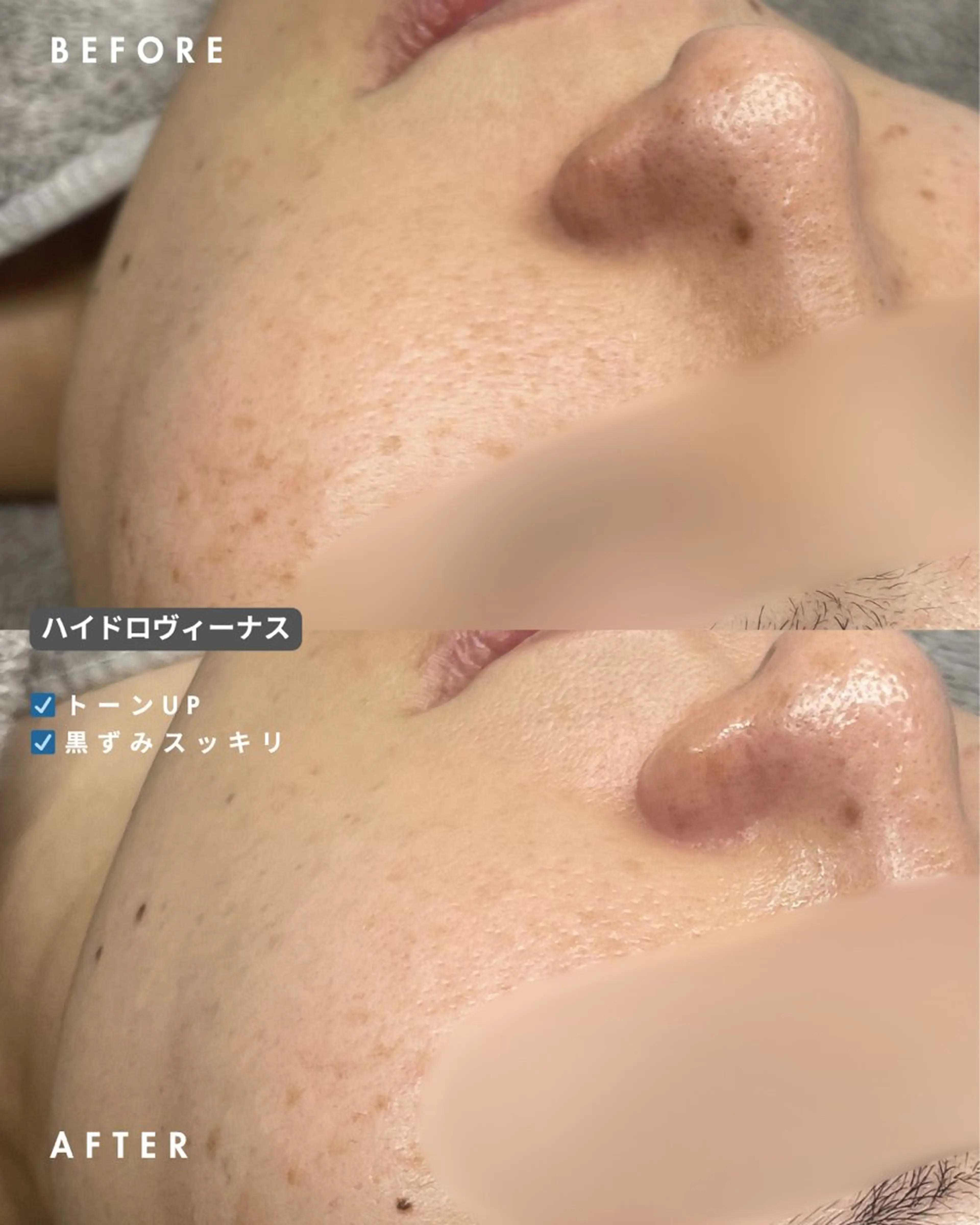 エステ cocofleur ココフルールのエステ・リラクイメージ