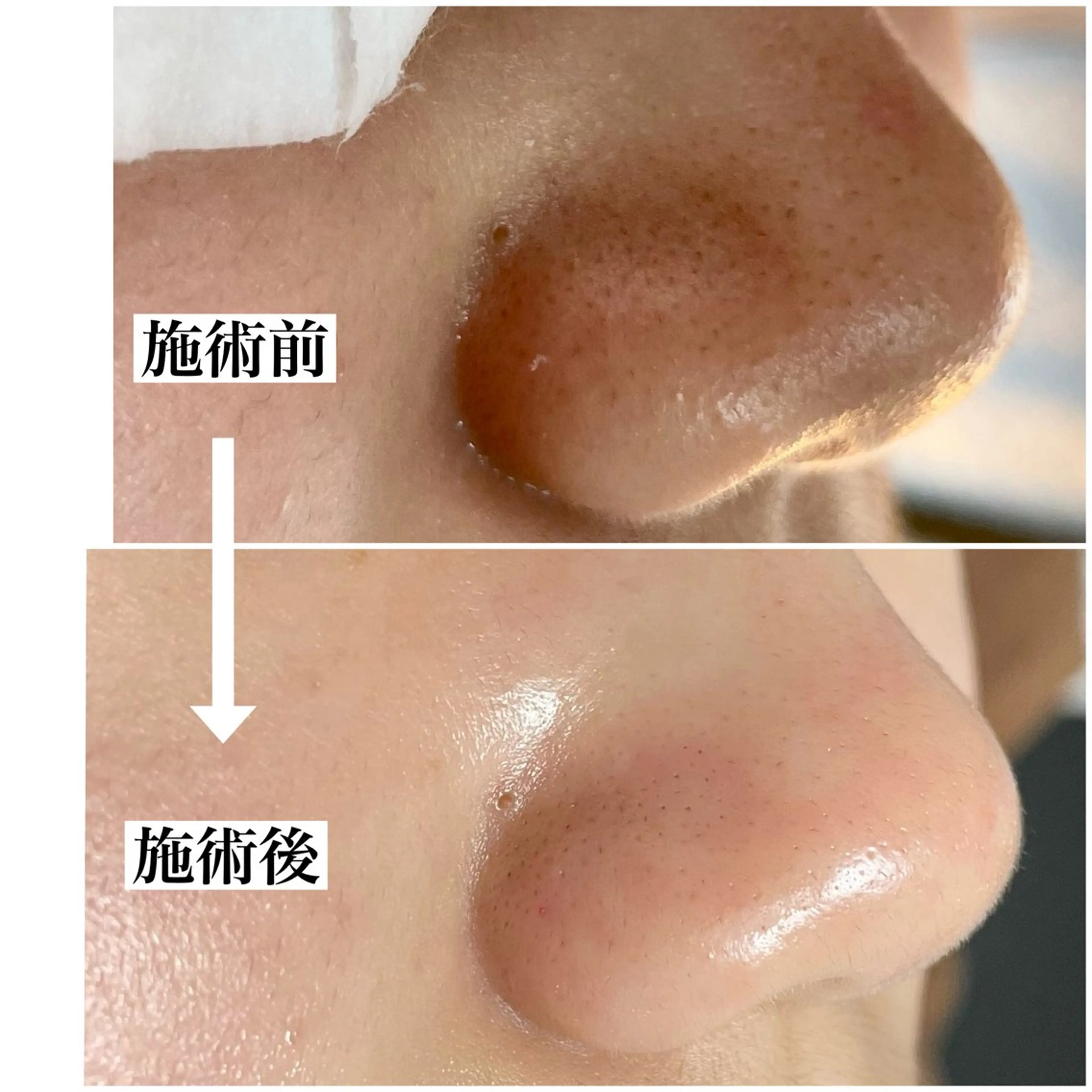 毛穴専門サロン MUKUムクのエステ・リラクイメージ