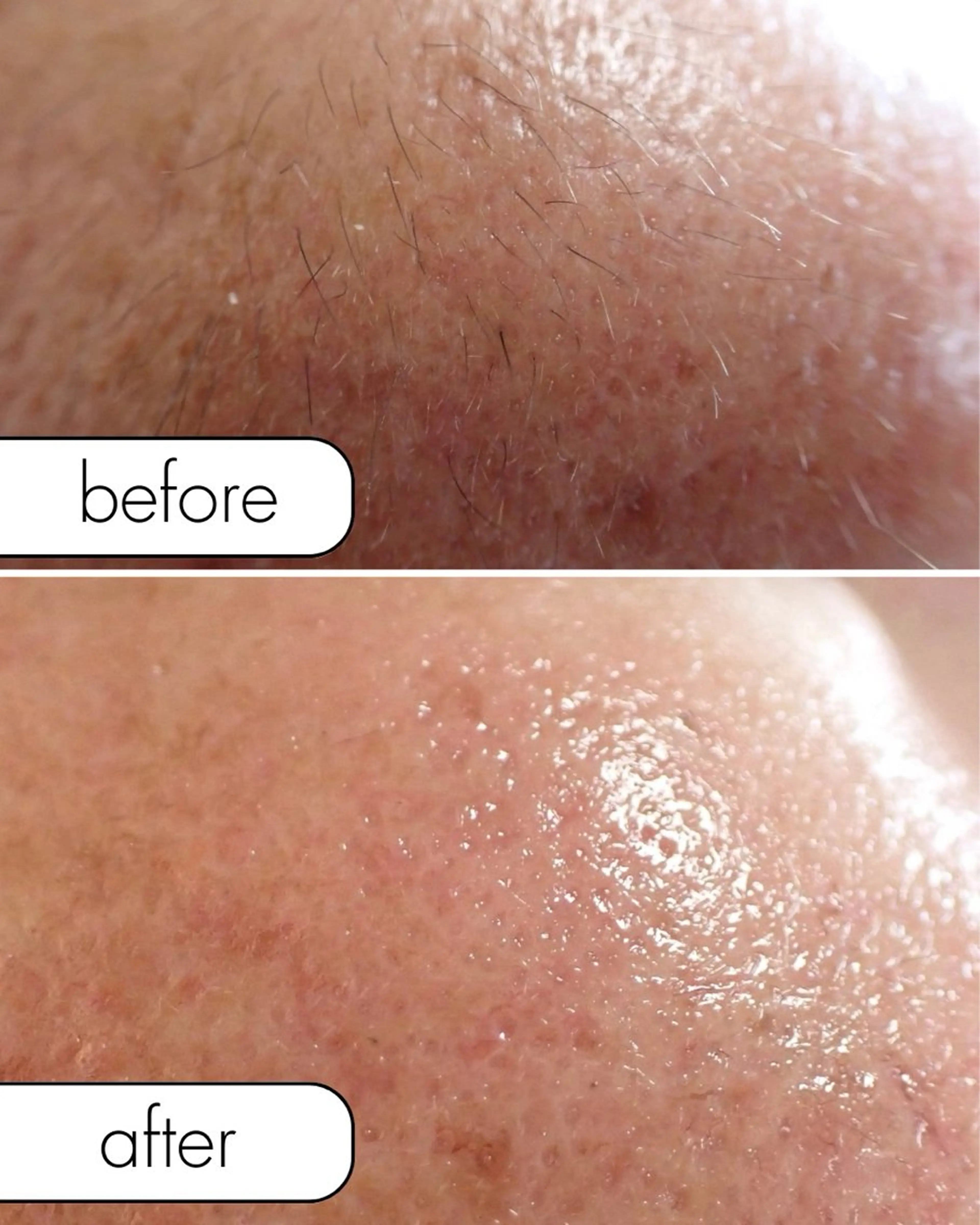 脱毛 蝶式糸除毛専門salon aco所属・糸除毛専門salon acoのエステ・リラクイメージ