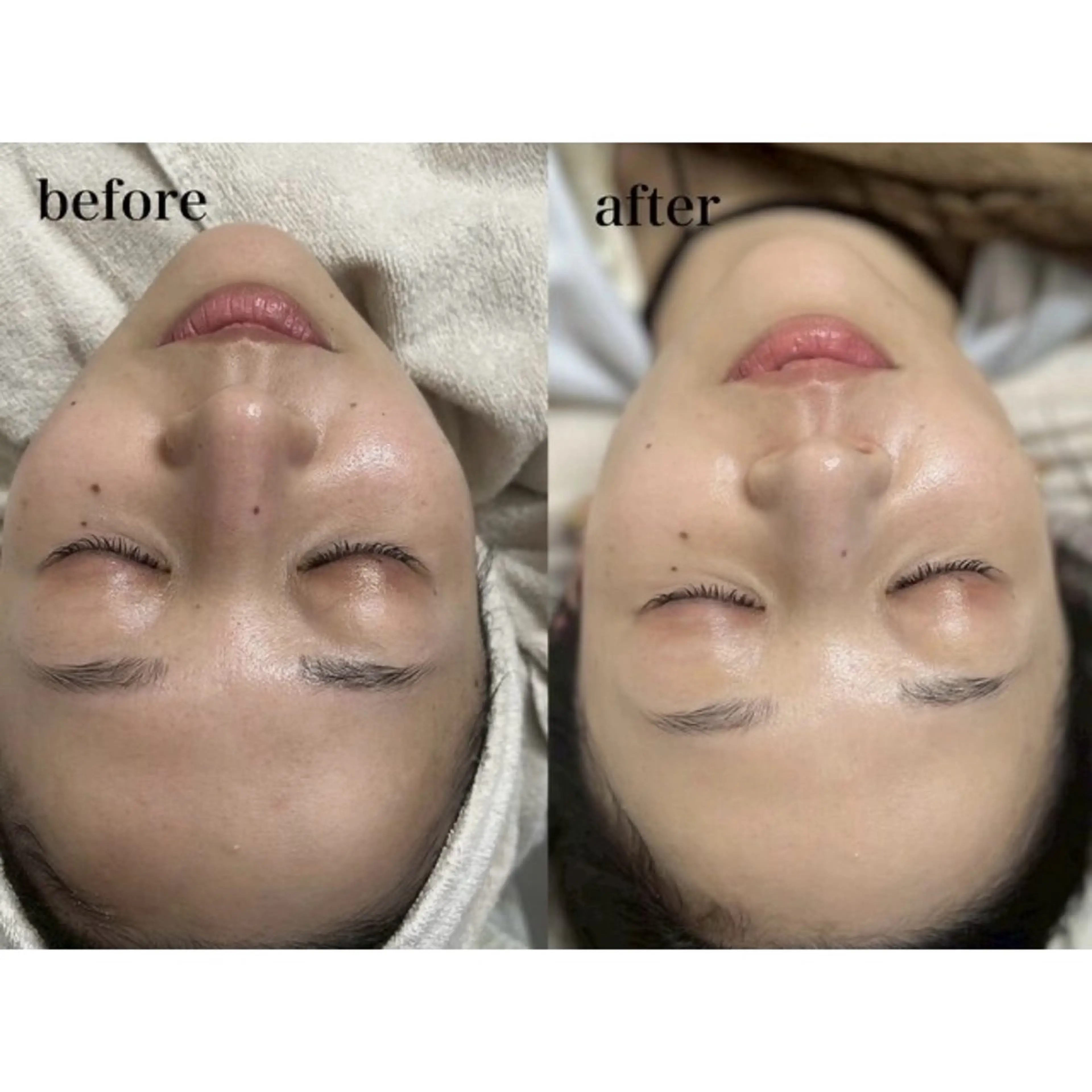 エステ 【LORAN】 yuneのエステ・リラクイメージ