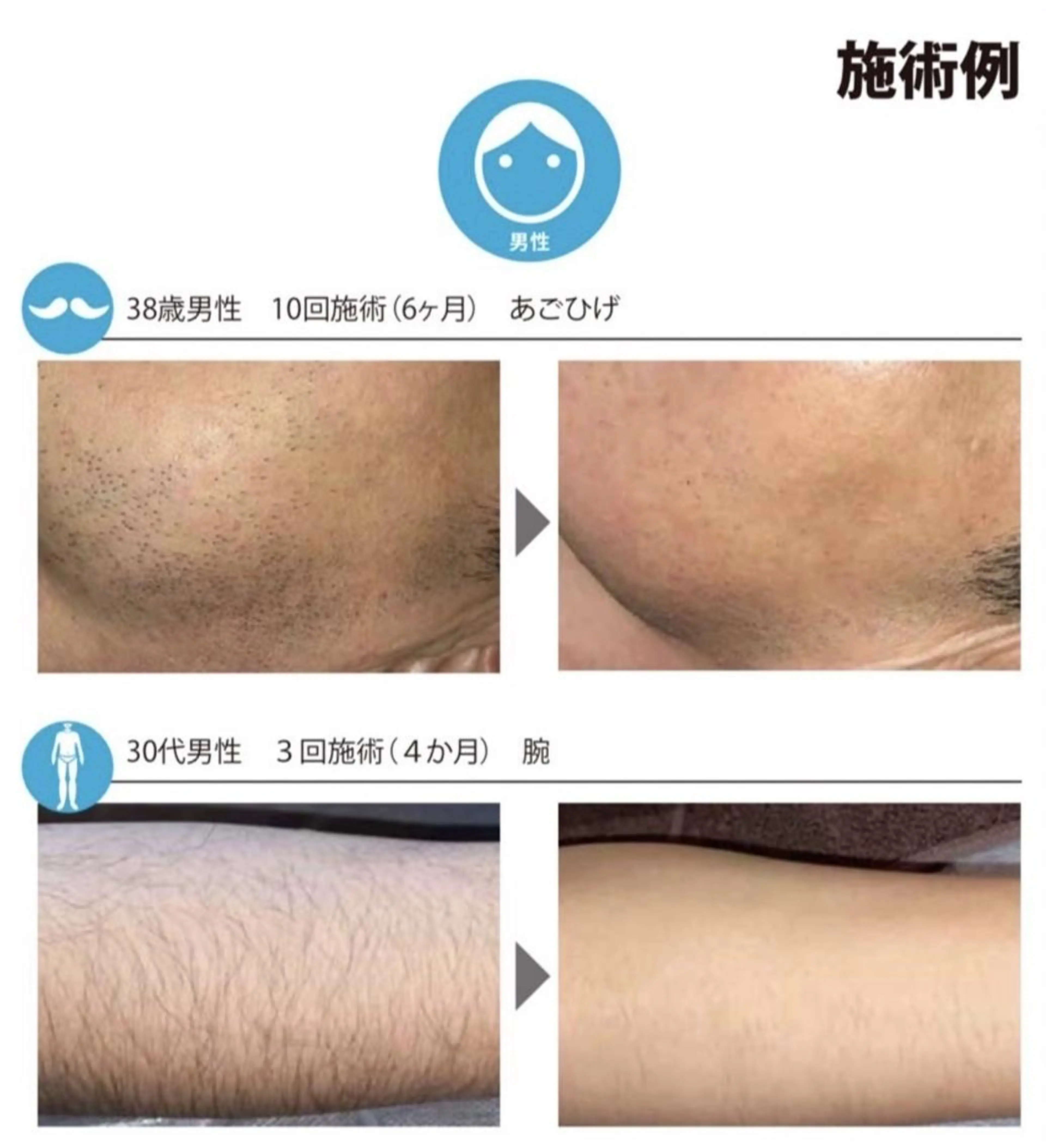 眠りの森/脱毛眉毛/ マッサージ/RINAのエステ・リラクイメージ