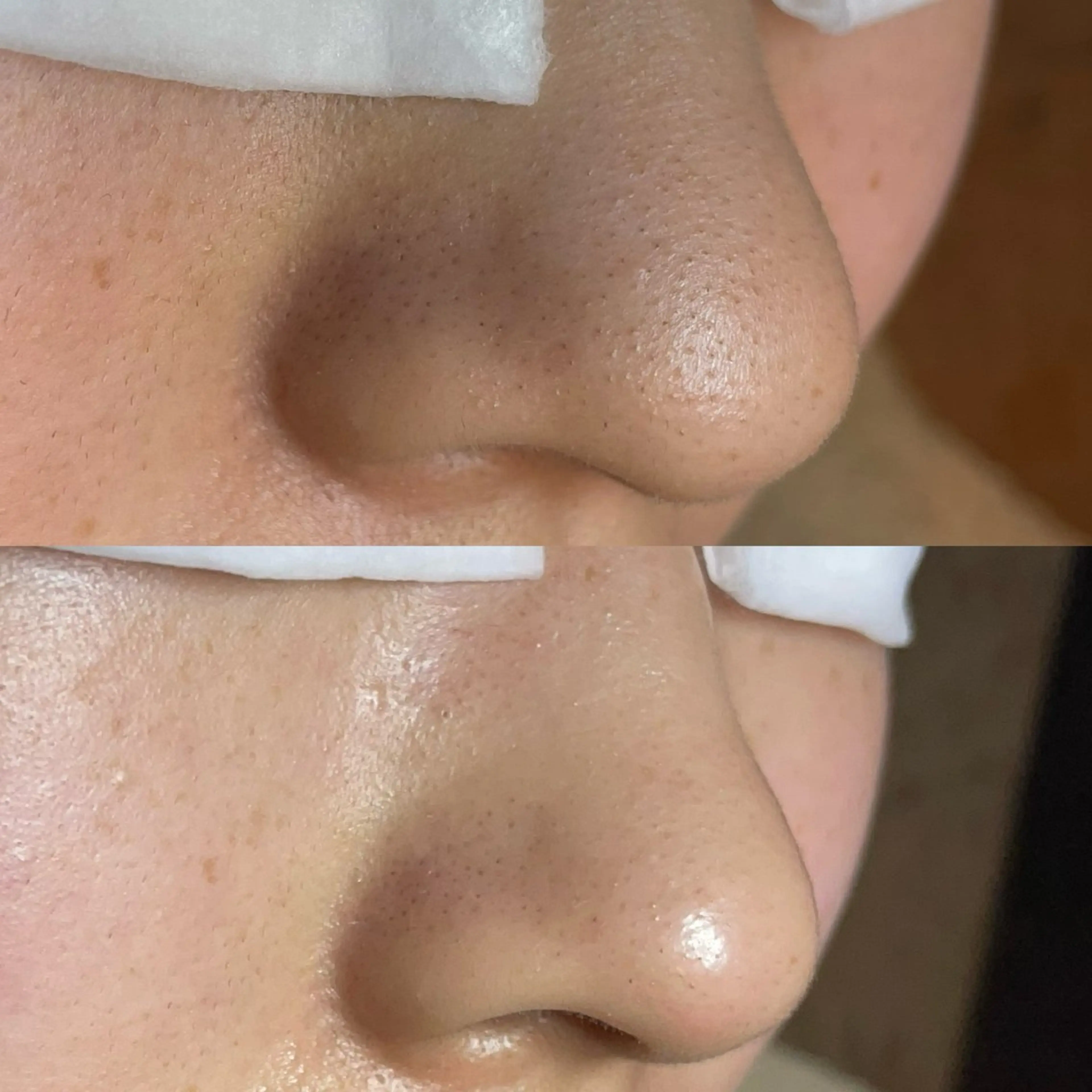 エステ Re:Belle 久留米 : 中島のエステ・リラクイメージ