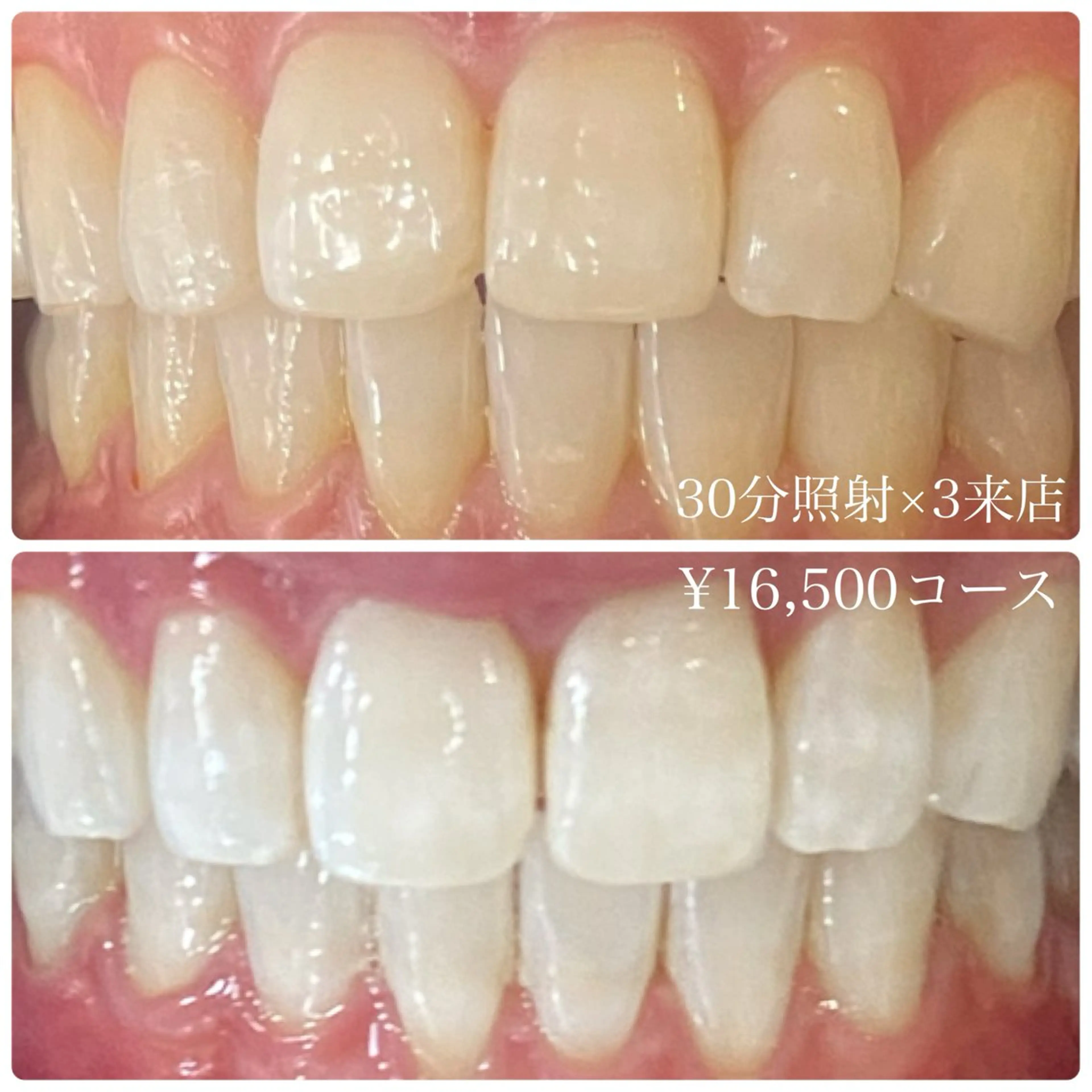 メンズ ホワイトニング ルーム　川崎店のその他イメージ