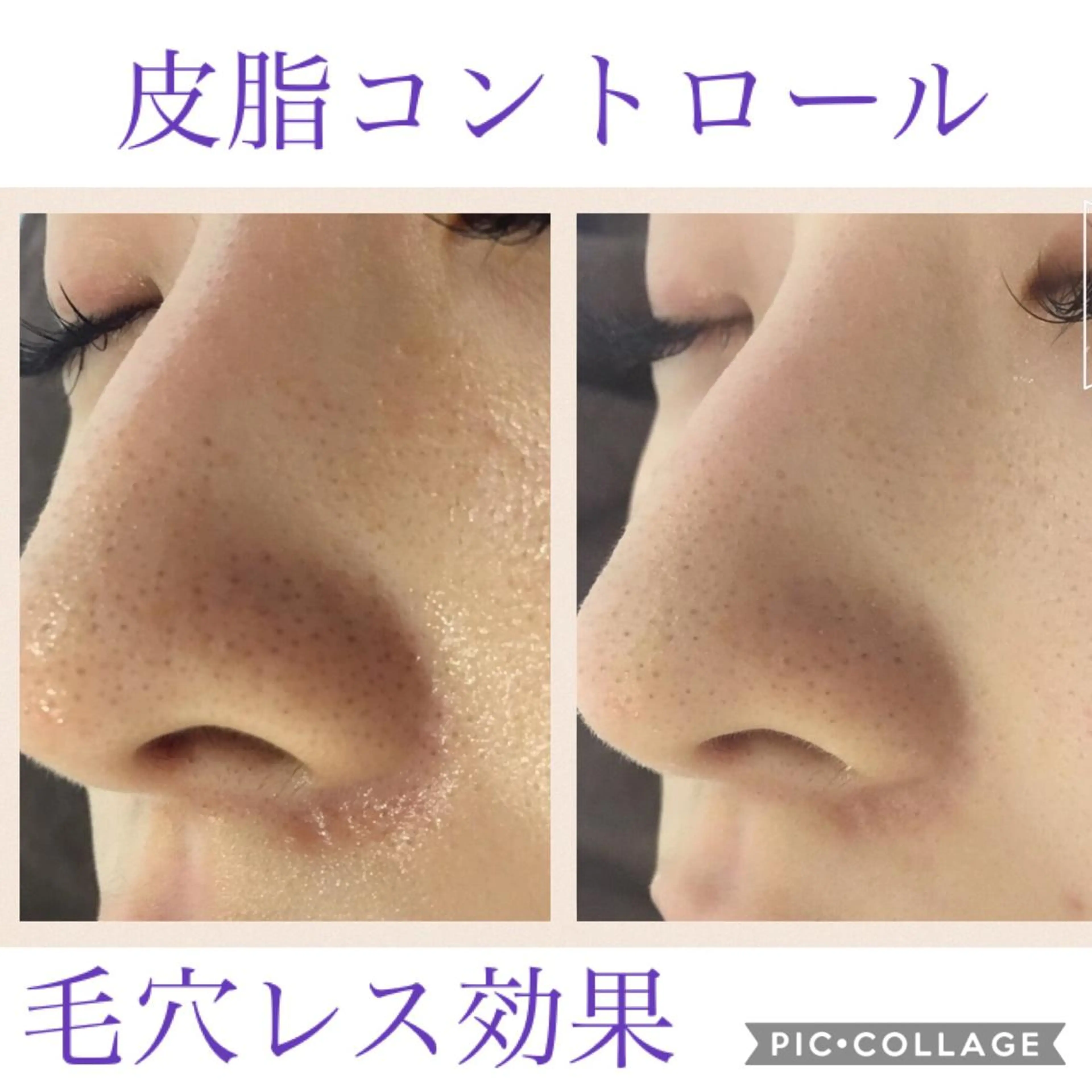 セミロング カラー パーマ ヘアアレンジ キッズ ネイル マツエク・マツパ EnsorClair 代表　野口真央のエステ・リラクイメージ