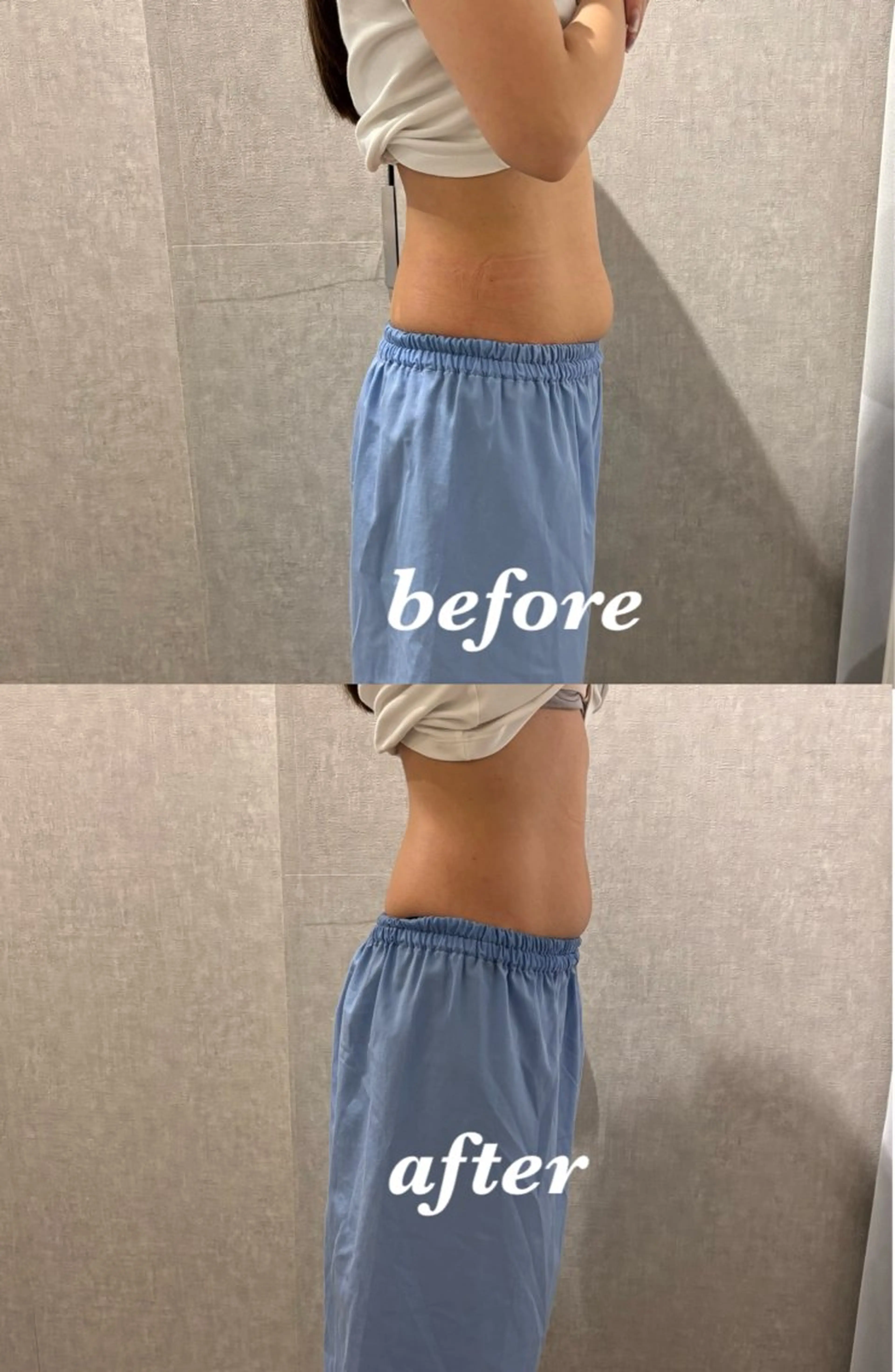 メンズ エステ リラク 腸活サポート みなみののエステ・リラクイメージ