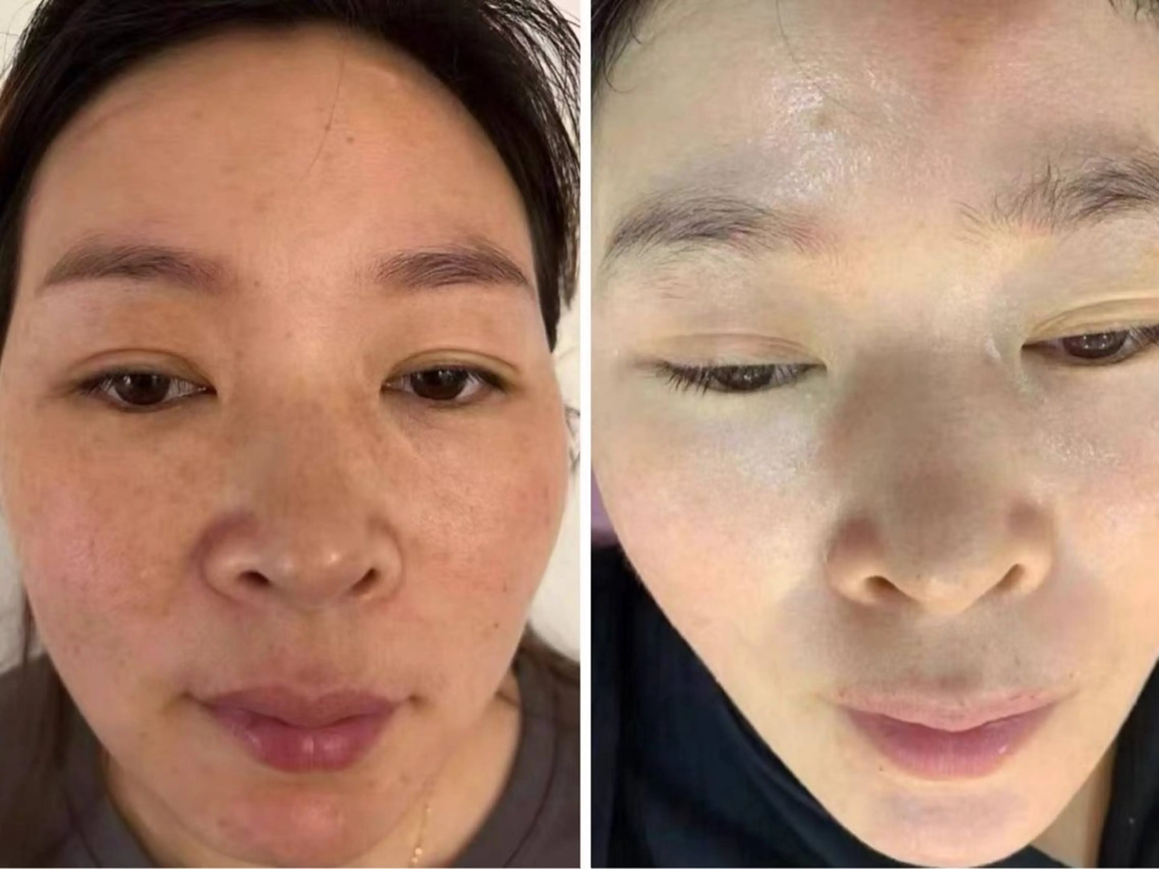 カラー エステ aliaハイフ&水光ジェットサロン所属・aliaハーブ水光店 エステティシャン募集のエステ・リラクイメージ