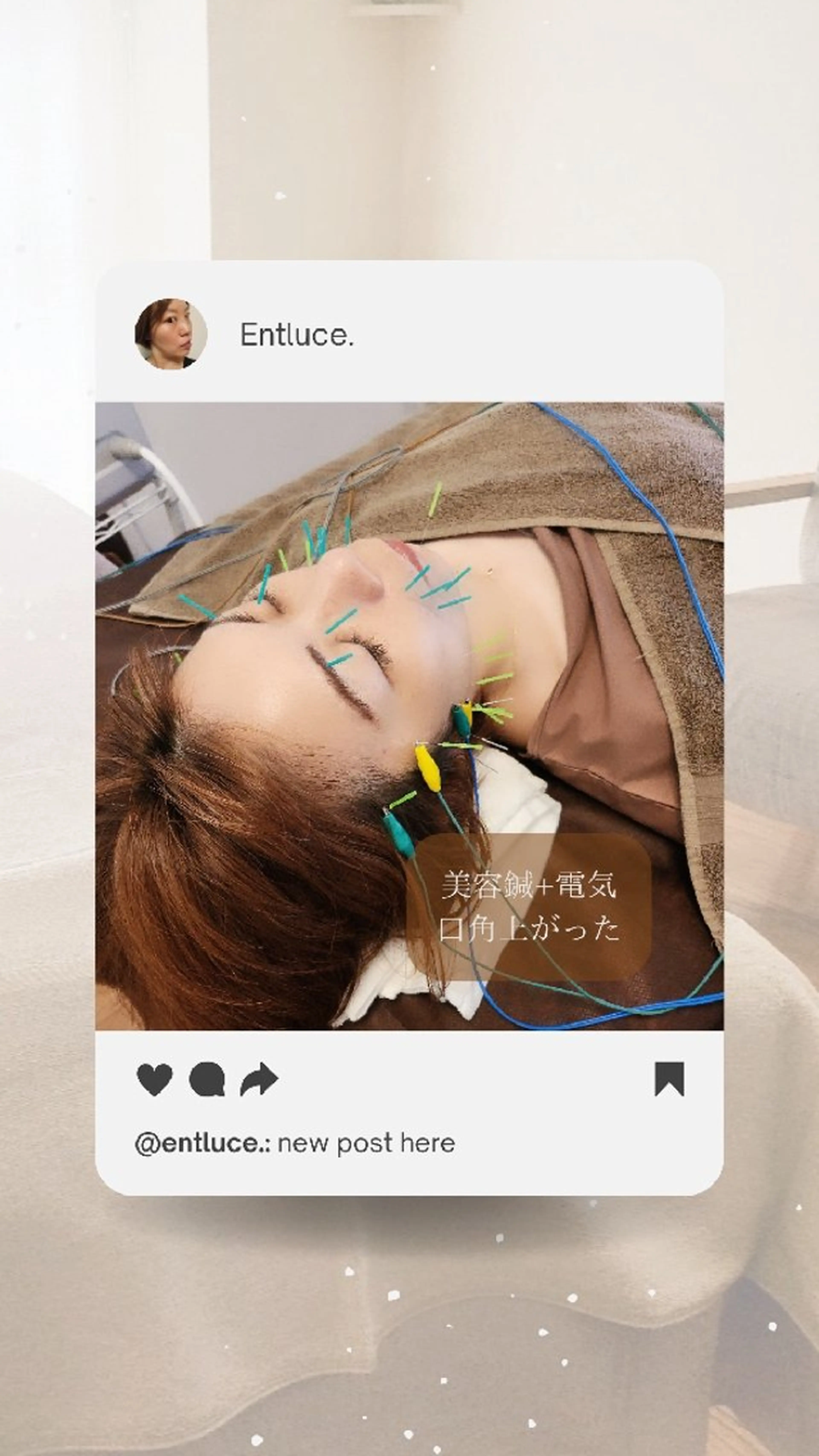 即効⚡小顔美容鍼🪡 むくみたるみ脂肪解消のエステ・リラクイメージ