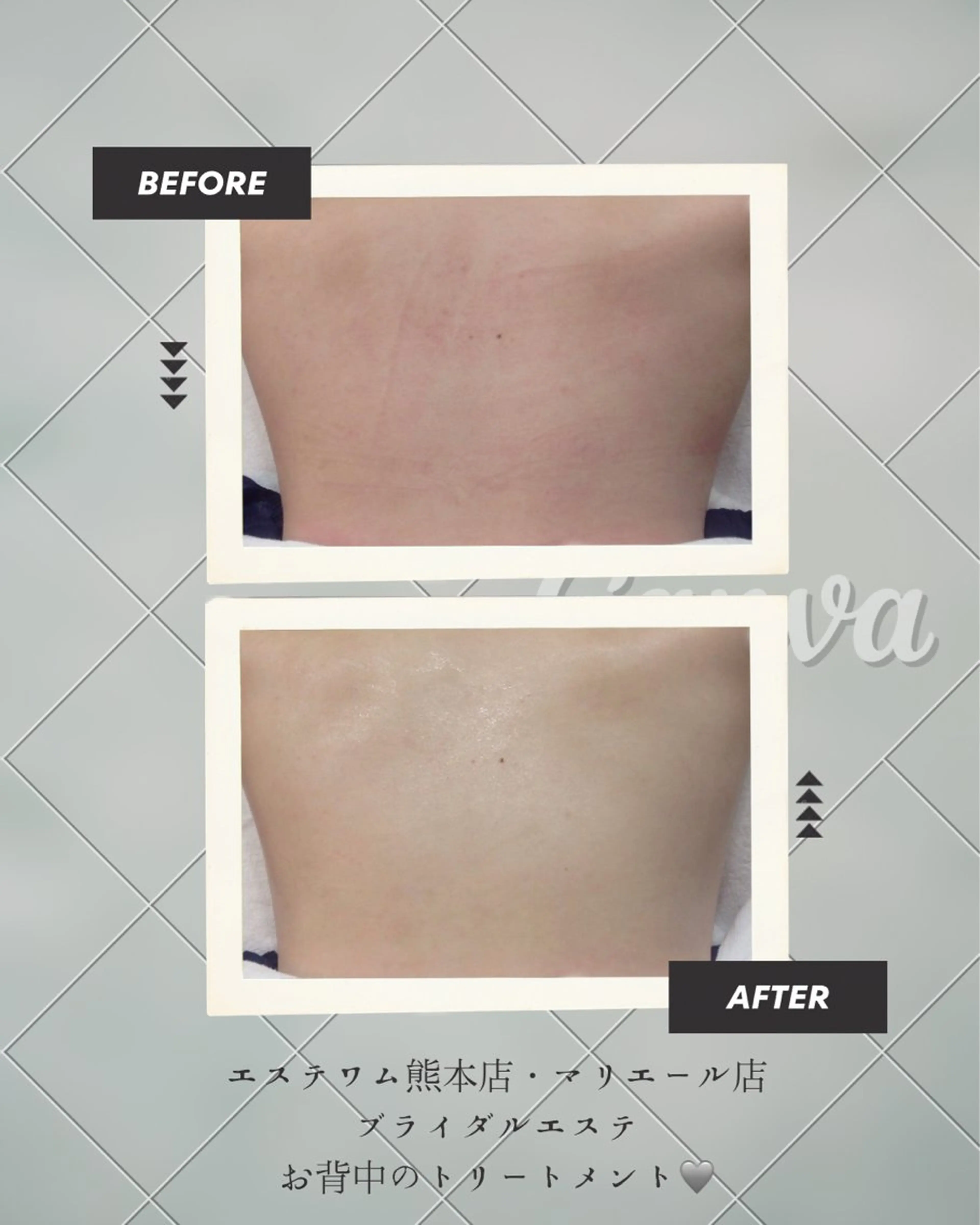 エステ エステWAM 髙木のエステ・リラクイメージ