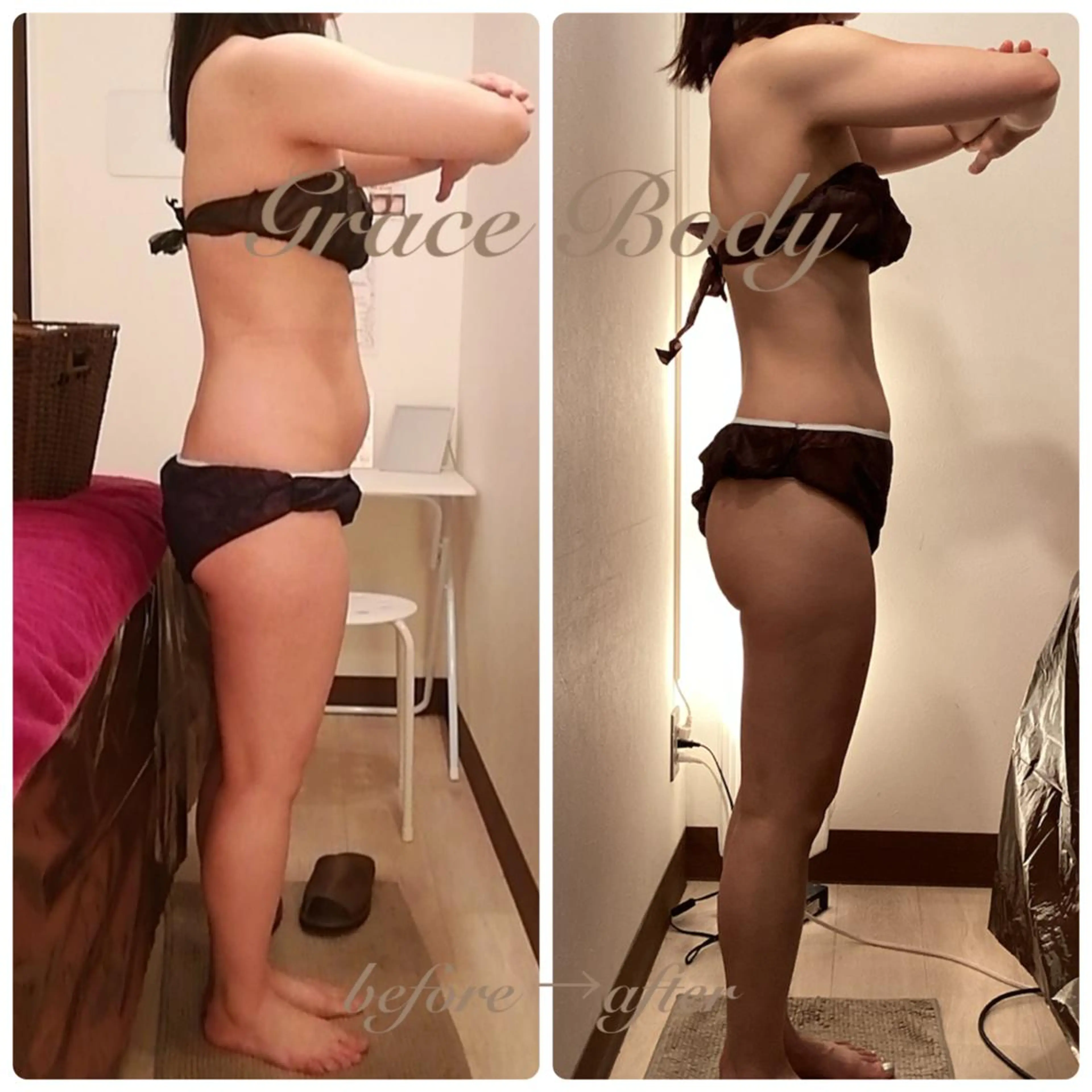 痩身・小顔・脱毛 グレイスボディのエステ・リラクイメージ