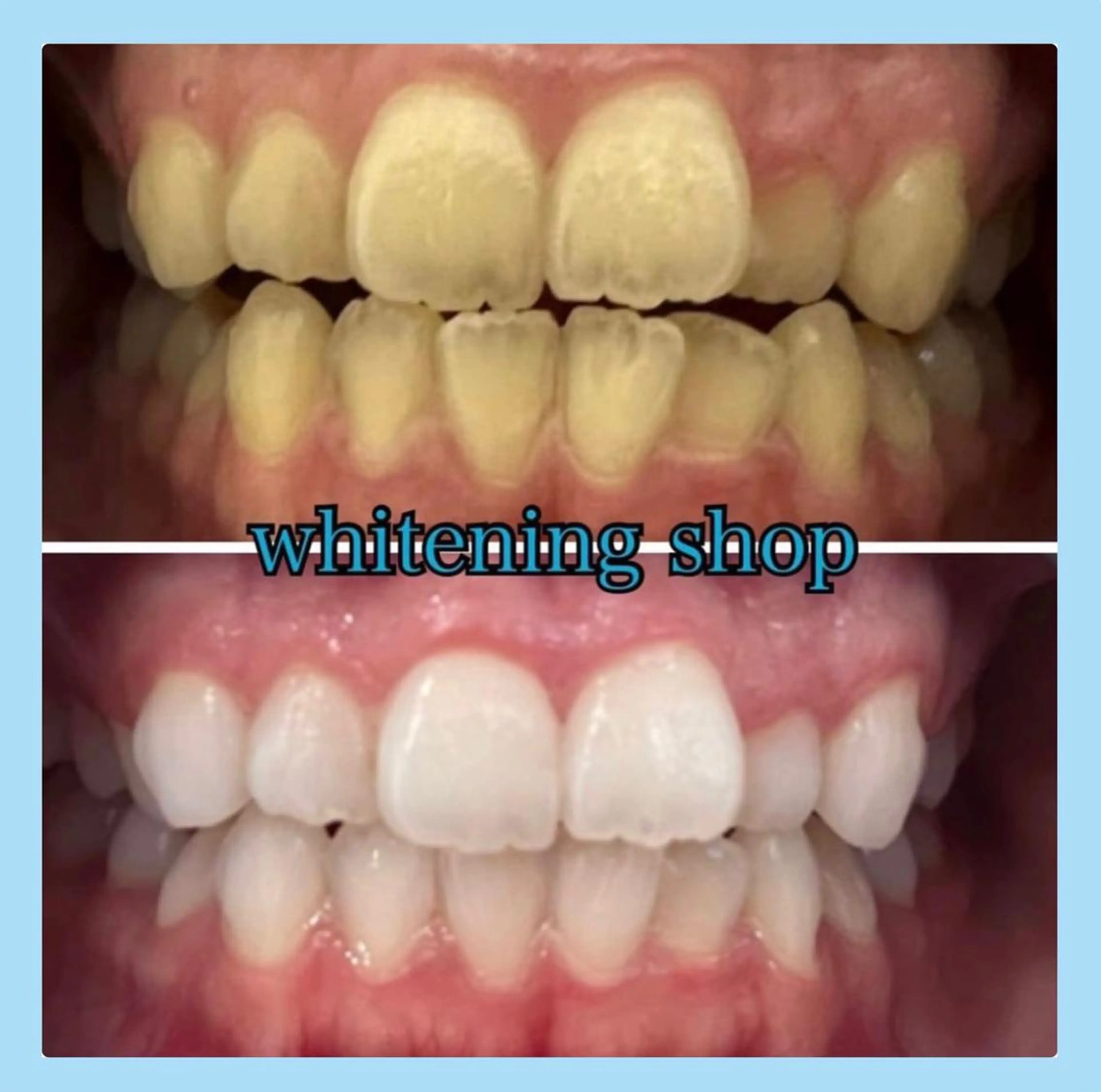 ホワイトニング ショップ千葉店のその他イメージ