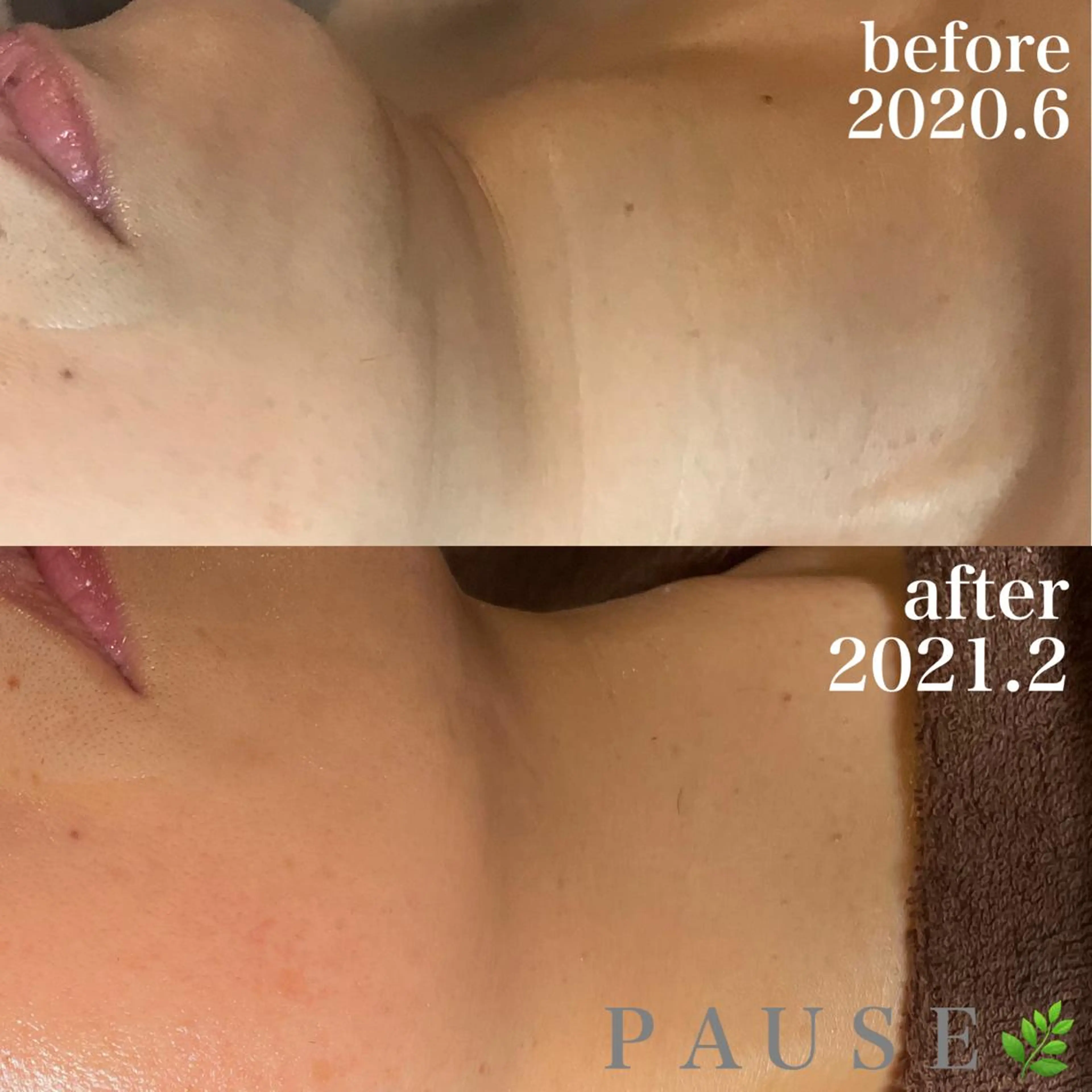 エステ 浜野 恵美のエステ・リラクイメージ