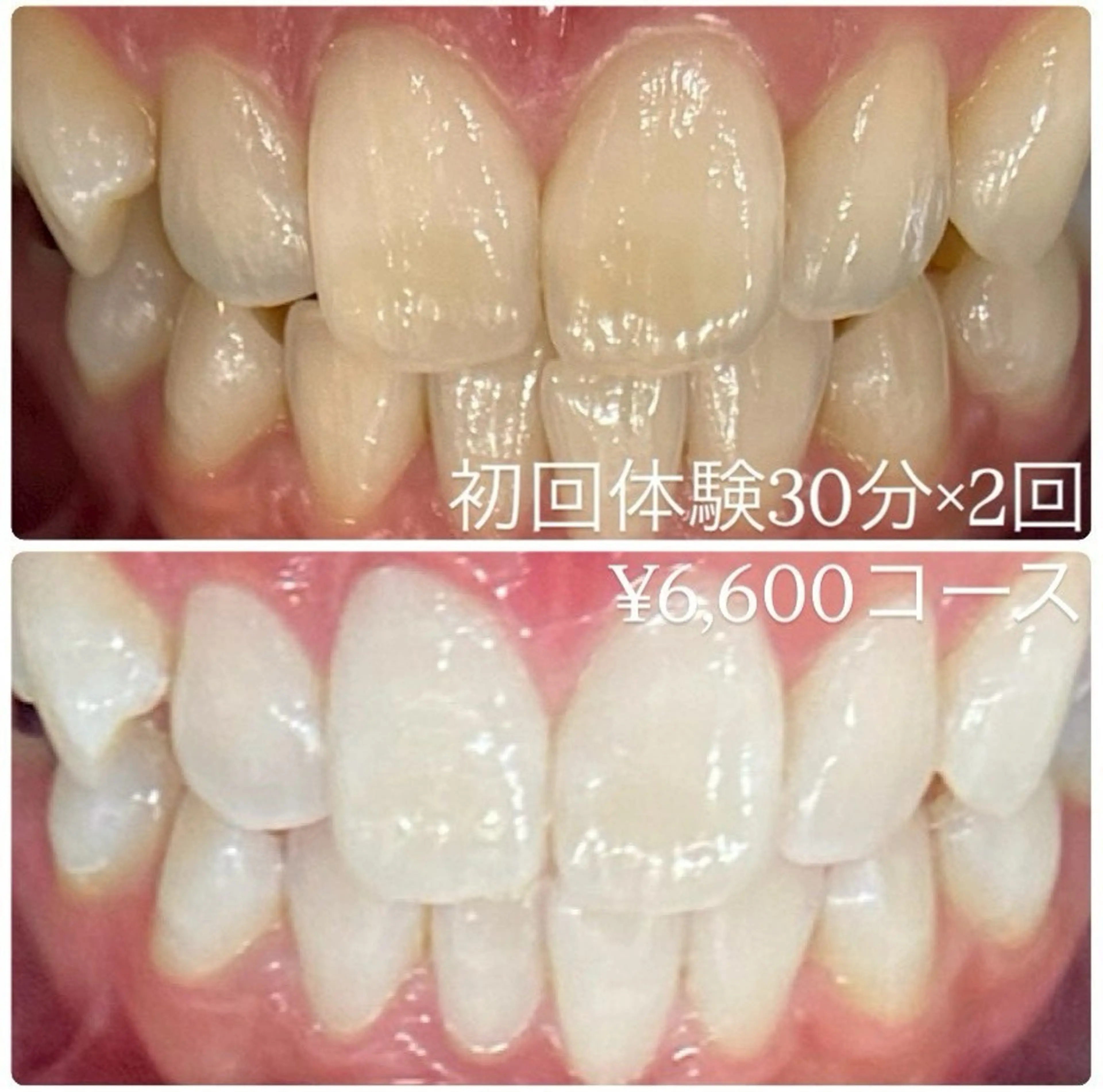 メンズ その他 ホワイトニング ルーム　川崎店のその他イメージ