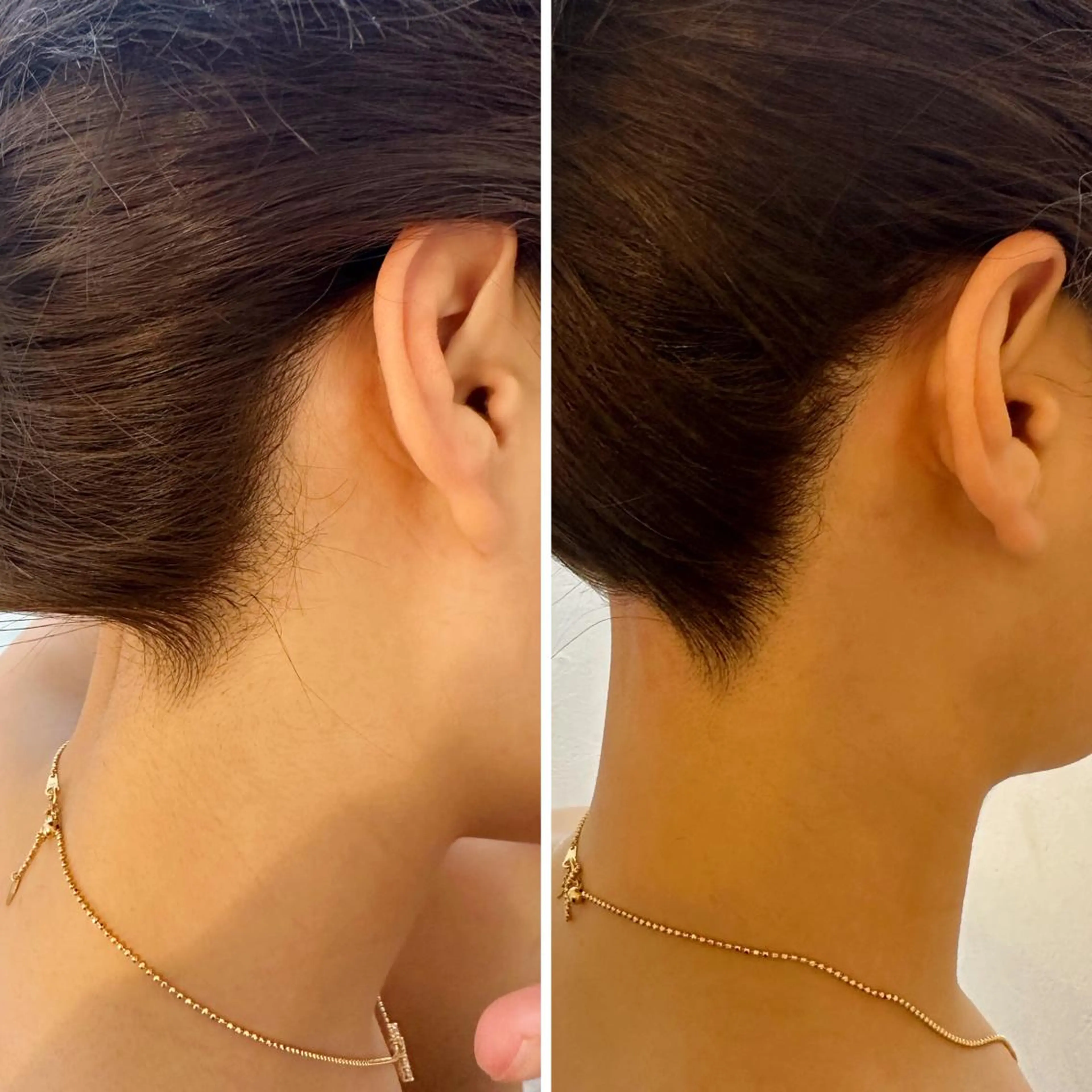 脱毛 うなじ脱毛/美肌脱毛 LABELのエステ・リラクイメージ