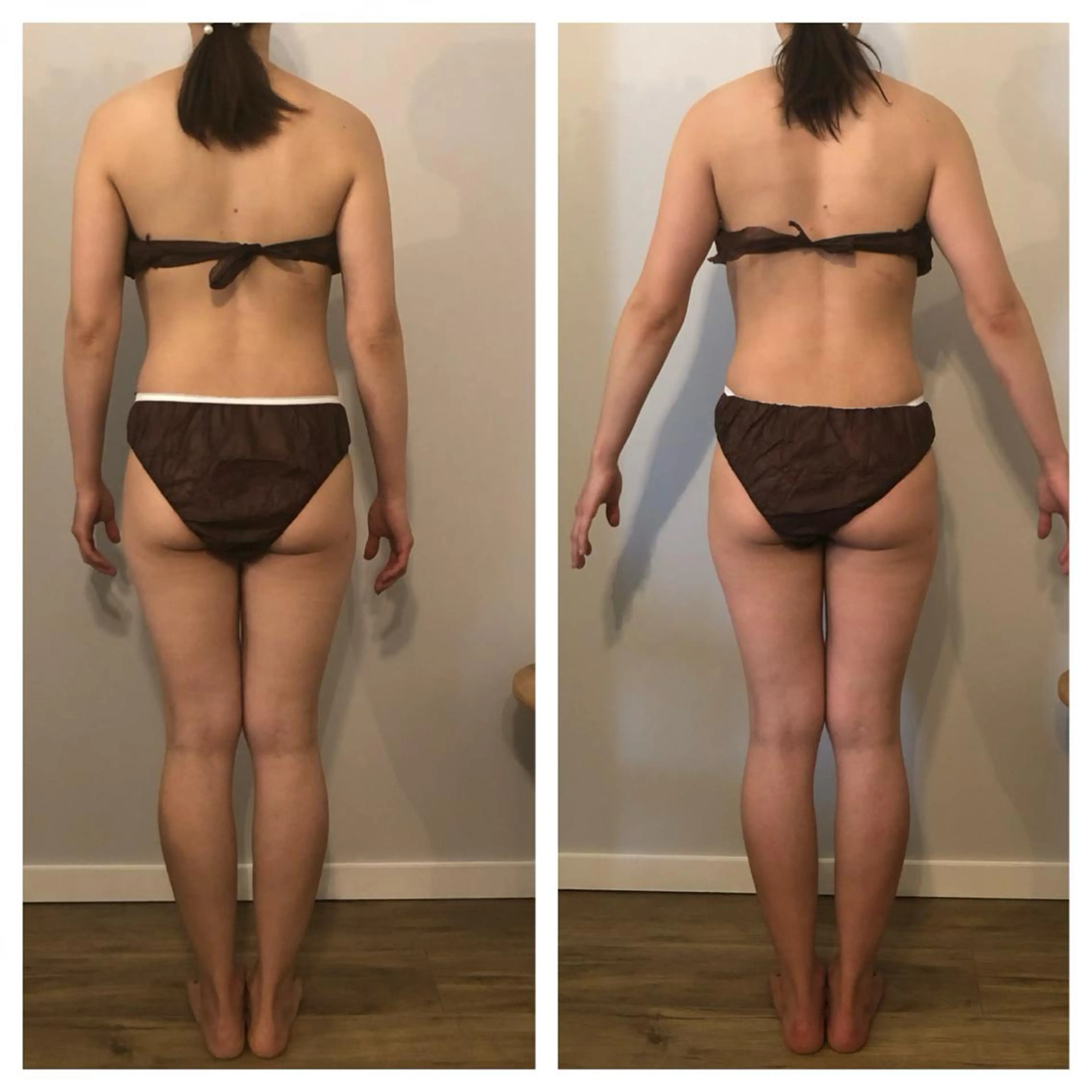 小顔.足痩せ整体 痩身天六Sunaoのその他イメージ