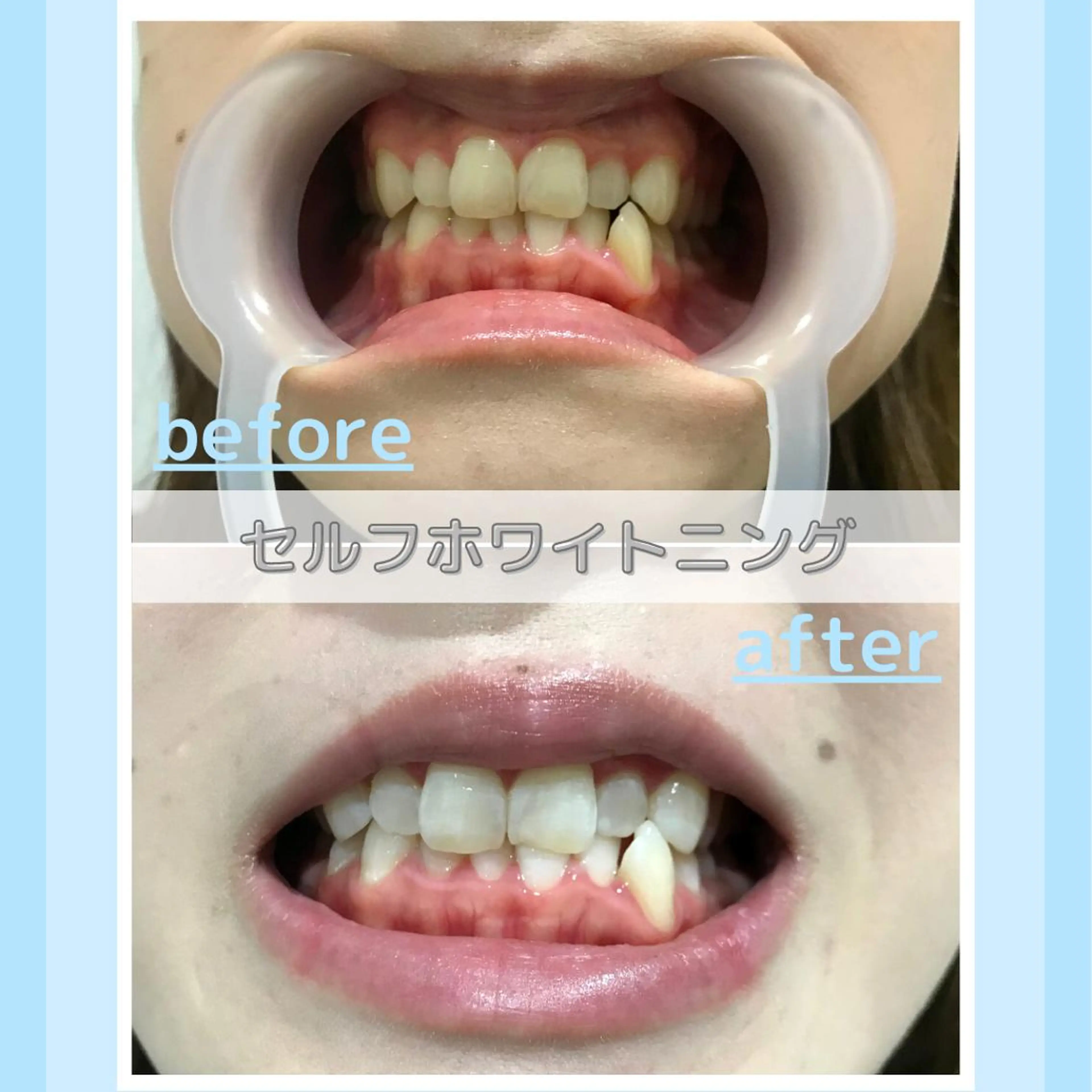 メンズ その他 お手軽ホワイトニングsalon mina所属・武元 奈津美のその他イメージ