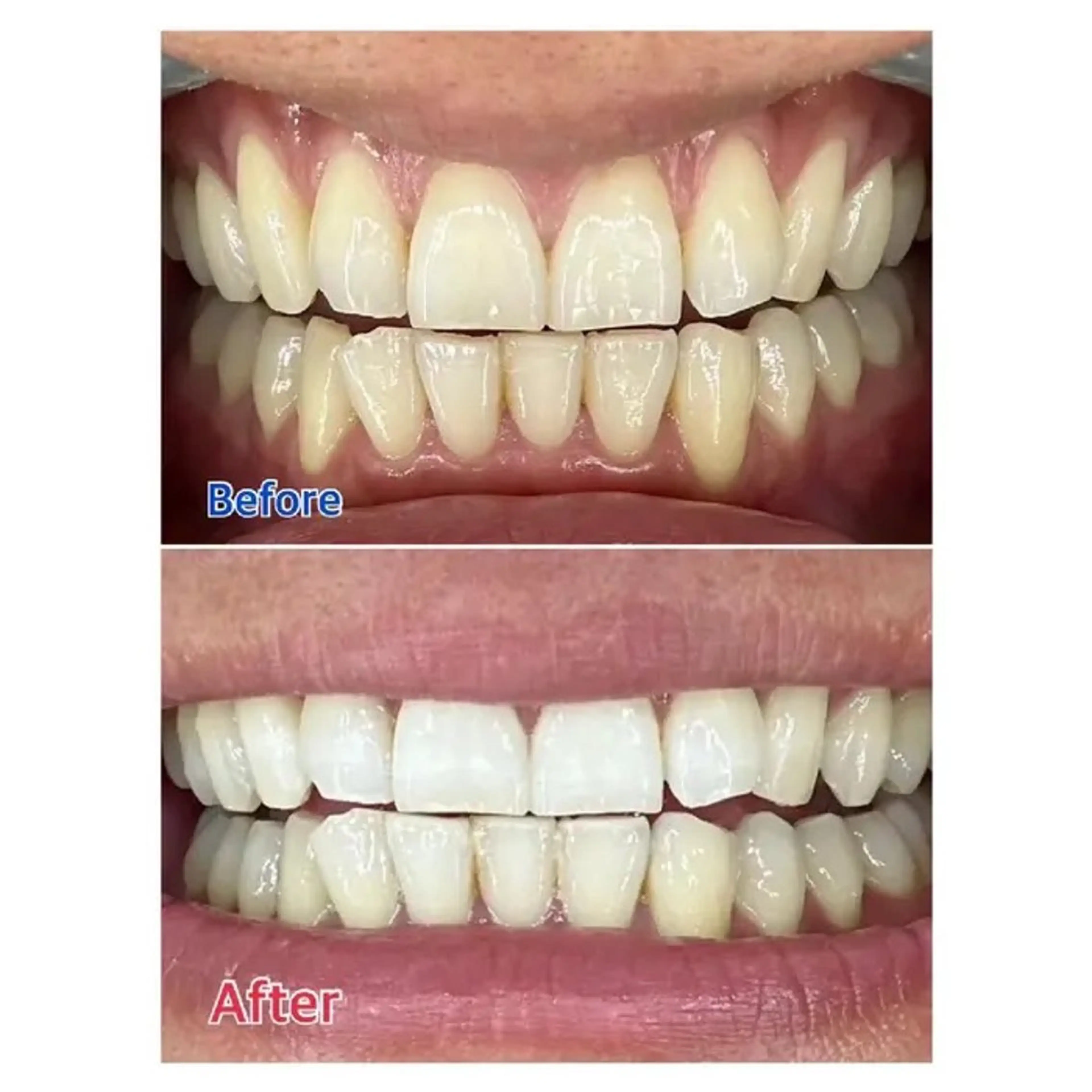 M渋谷 ホワイトニングのエステ・リラクイメージ