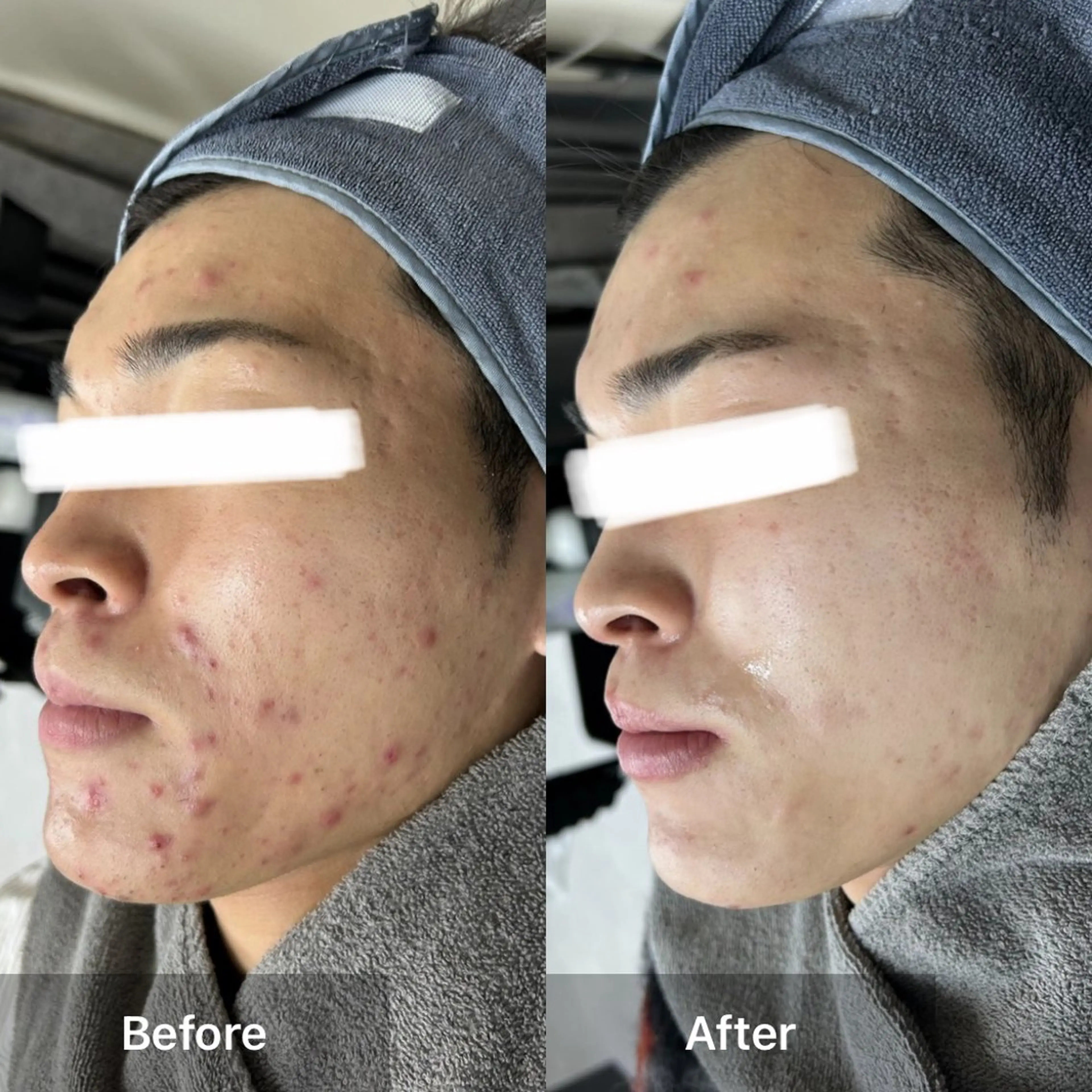 エステ ハーブピーリング専門 MOKAのエステ・リラクイメージ