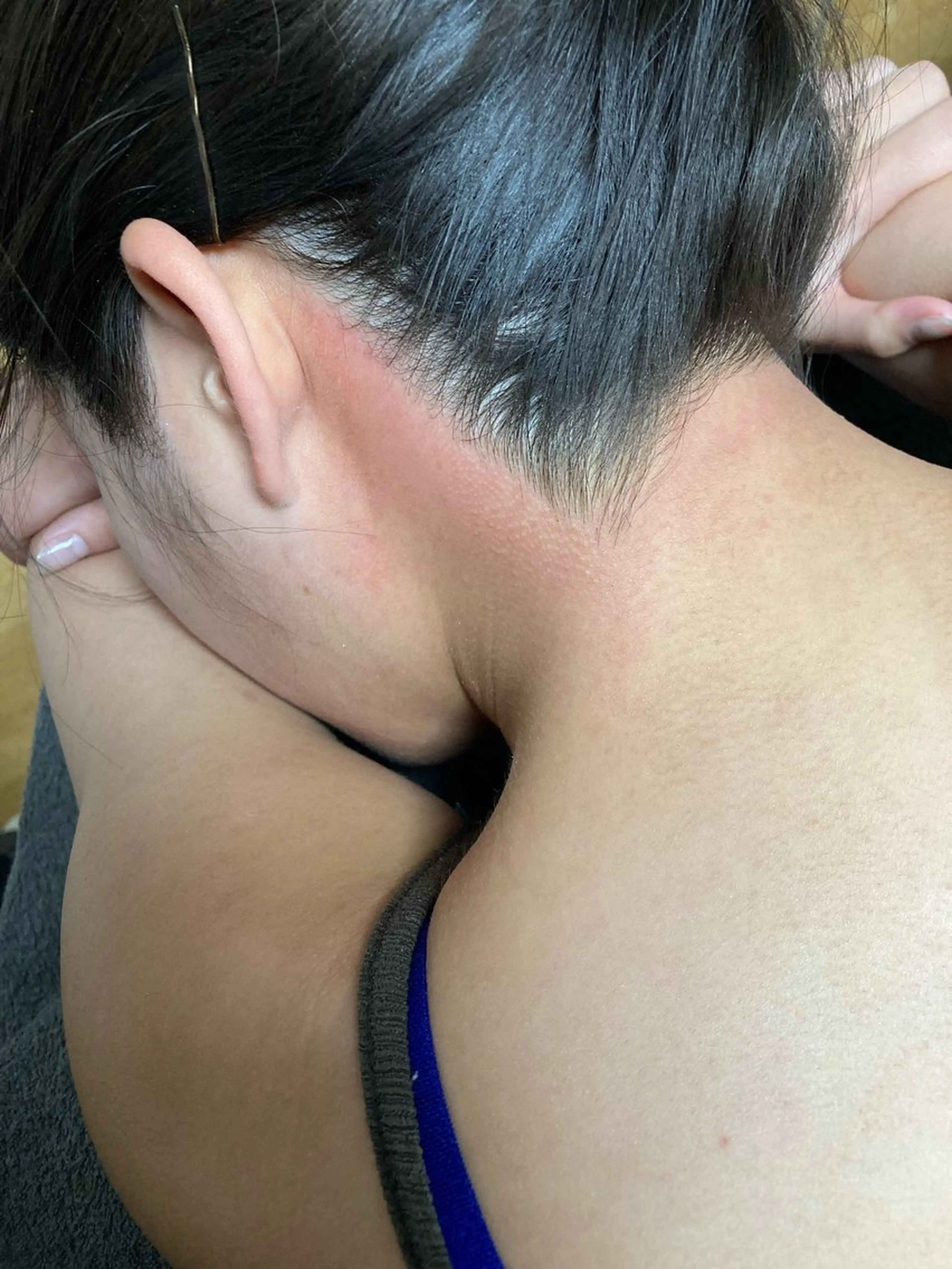 脱毛 Ohata Megumiの眉毛・アイブロウイメージ