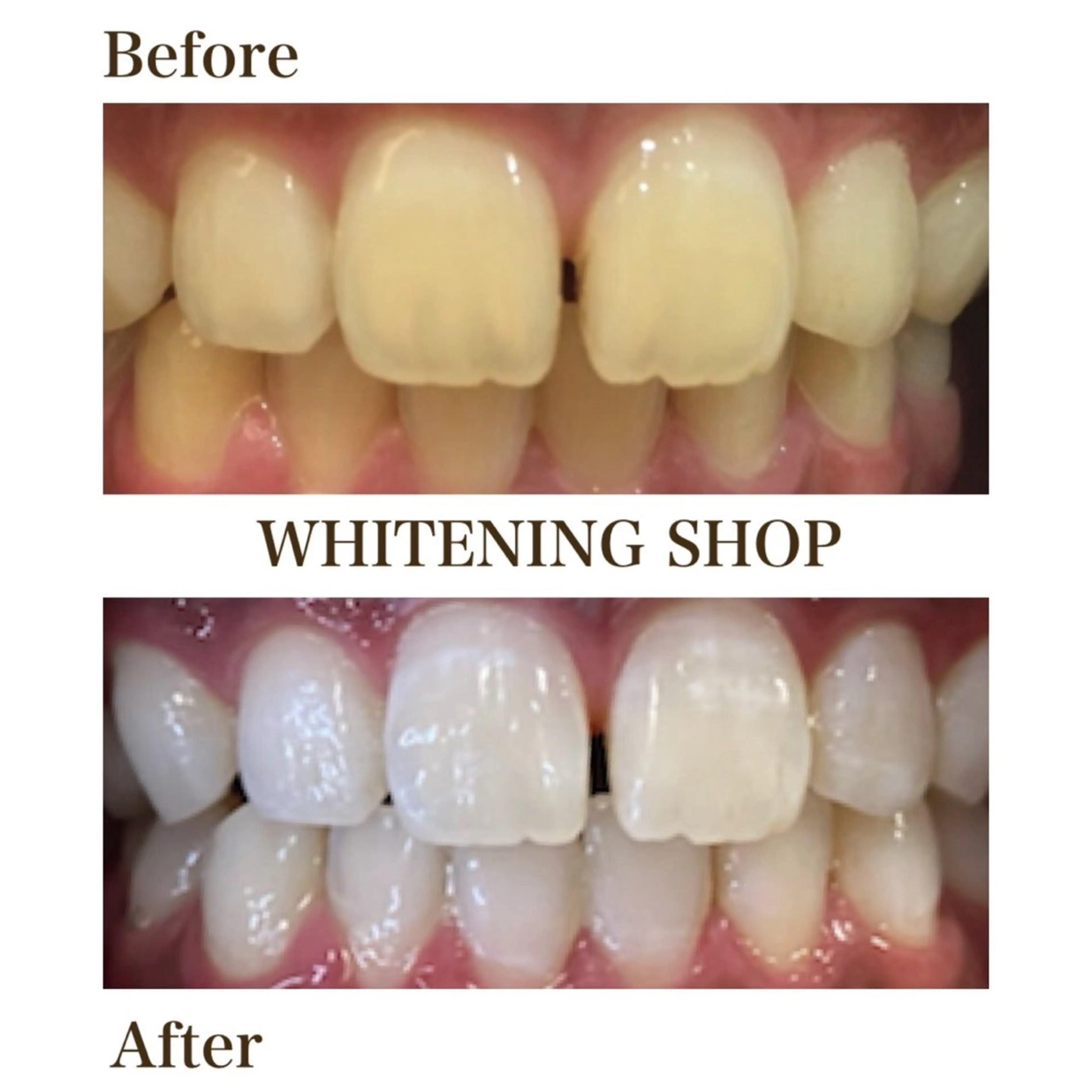 メンズ エステ リラク ホワイトニング ショップ川越店のエステ・リラクイメージ