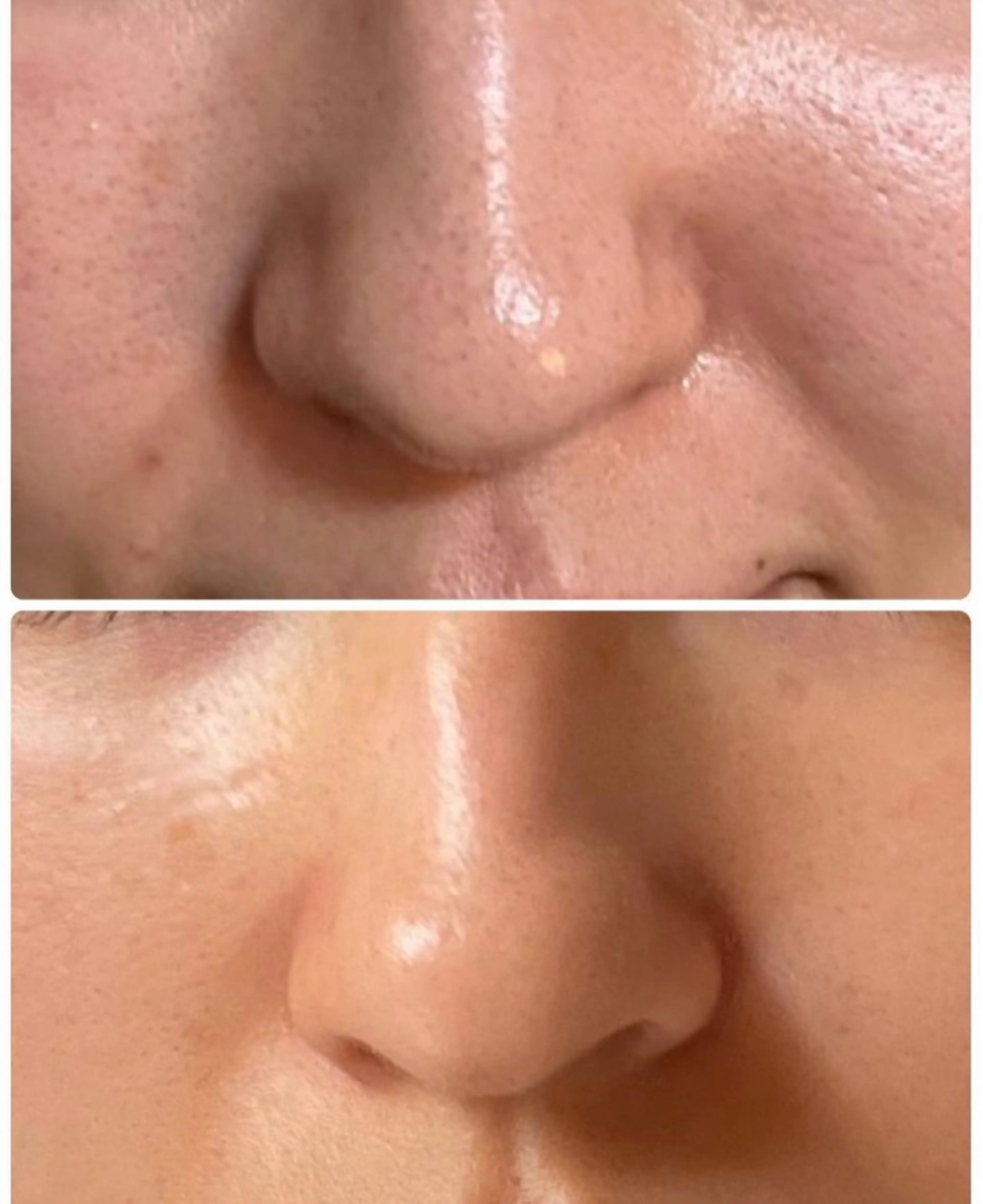 エステ Sena Dewi 🫧Ayakaのエステ・リラクイメージ