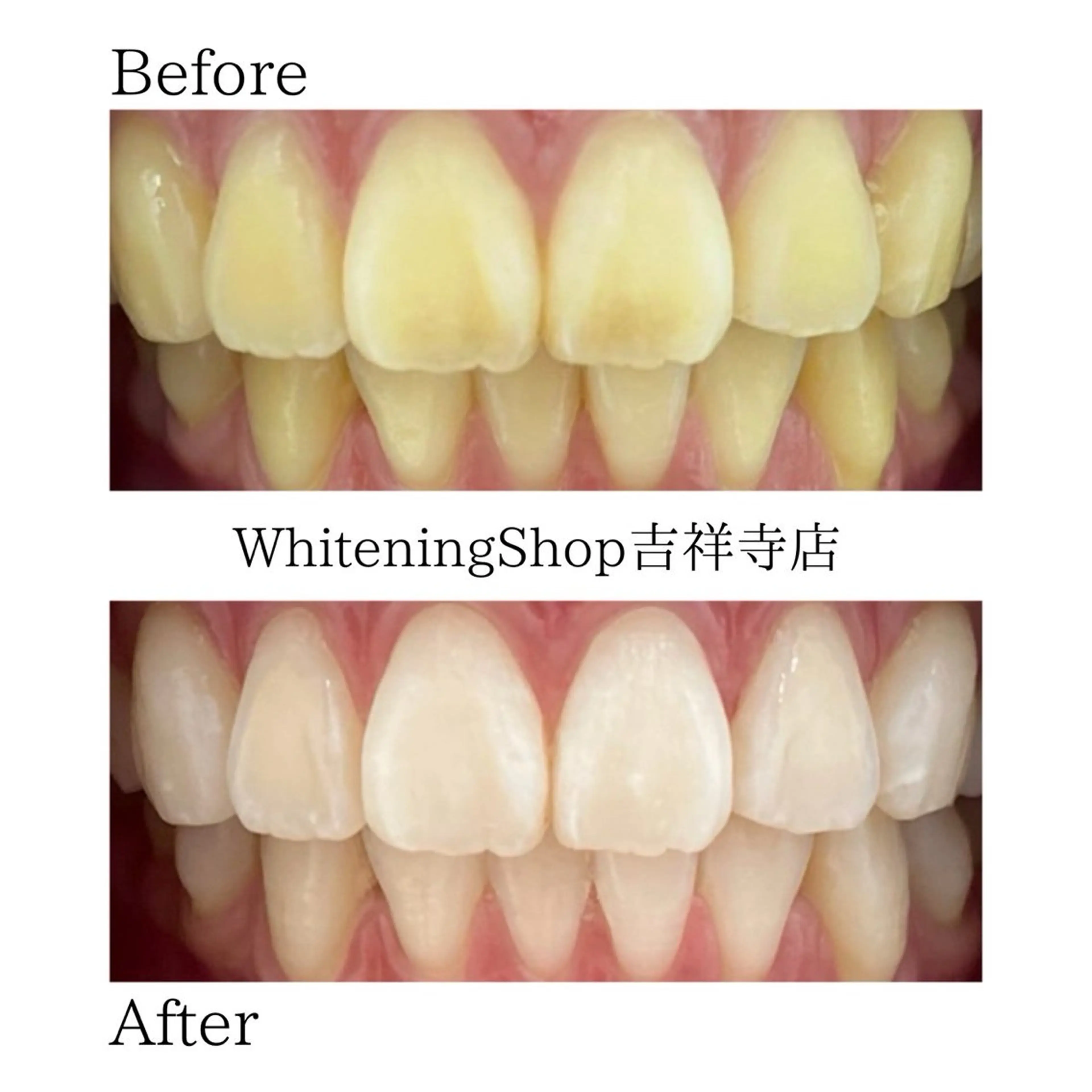 エステ リラク ホワイトニング ショップ吉祥寺店のエステ・リラクイメージ