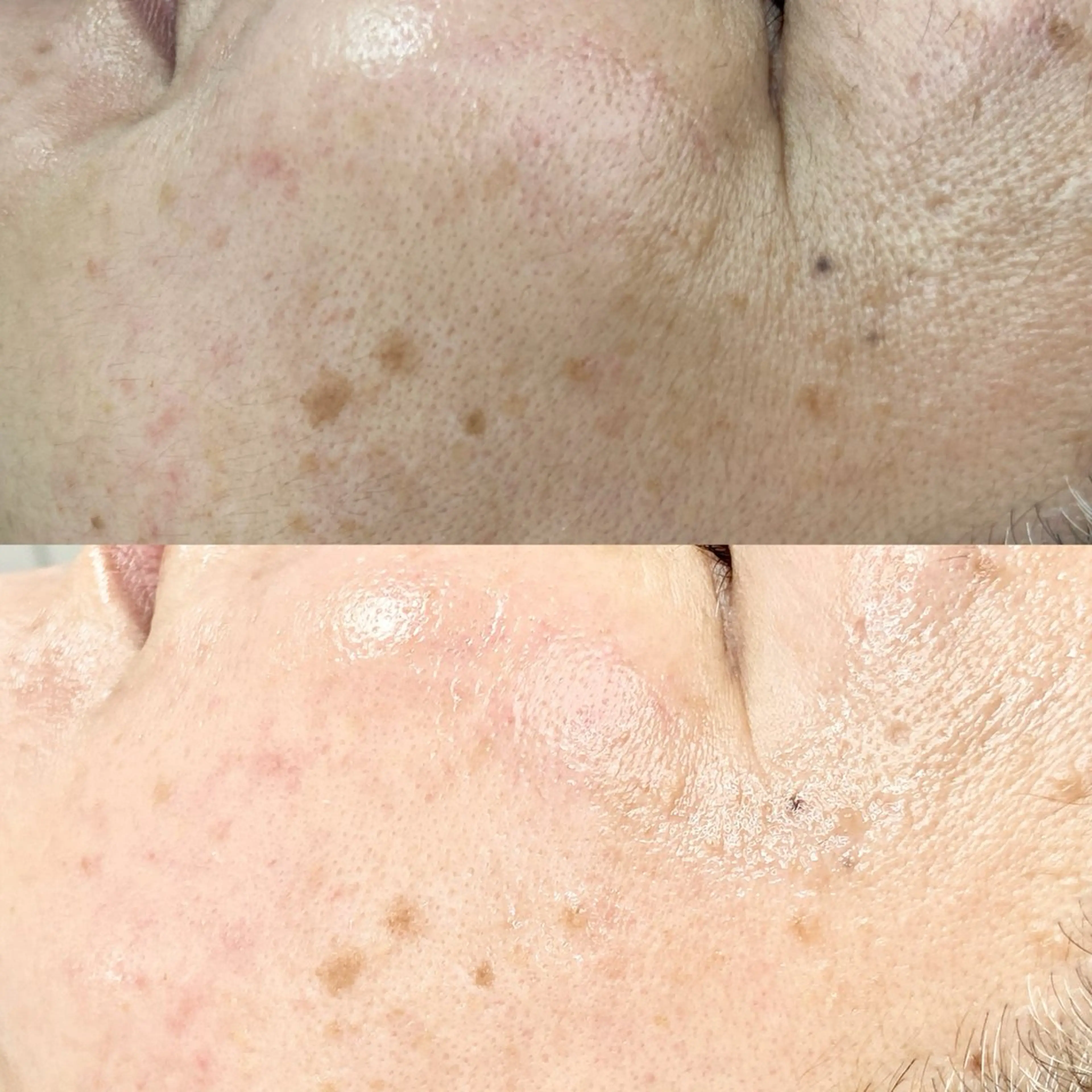 脱毛 &me ayakaのエステ・リラクイメージ