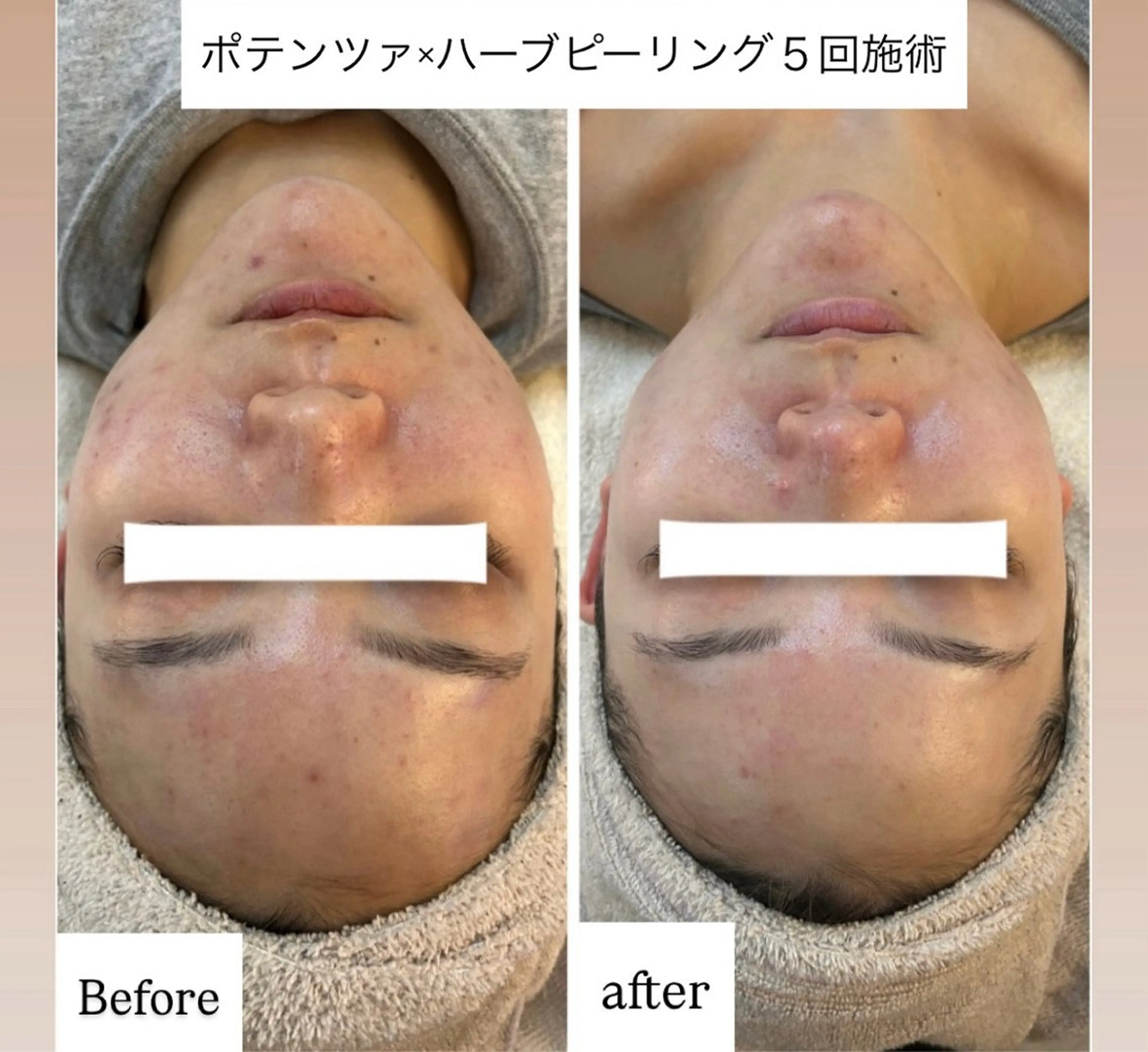 エステ 肌管理 OGUMOのエステ・リラクイメージ