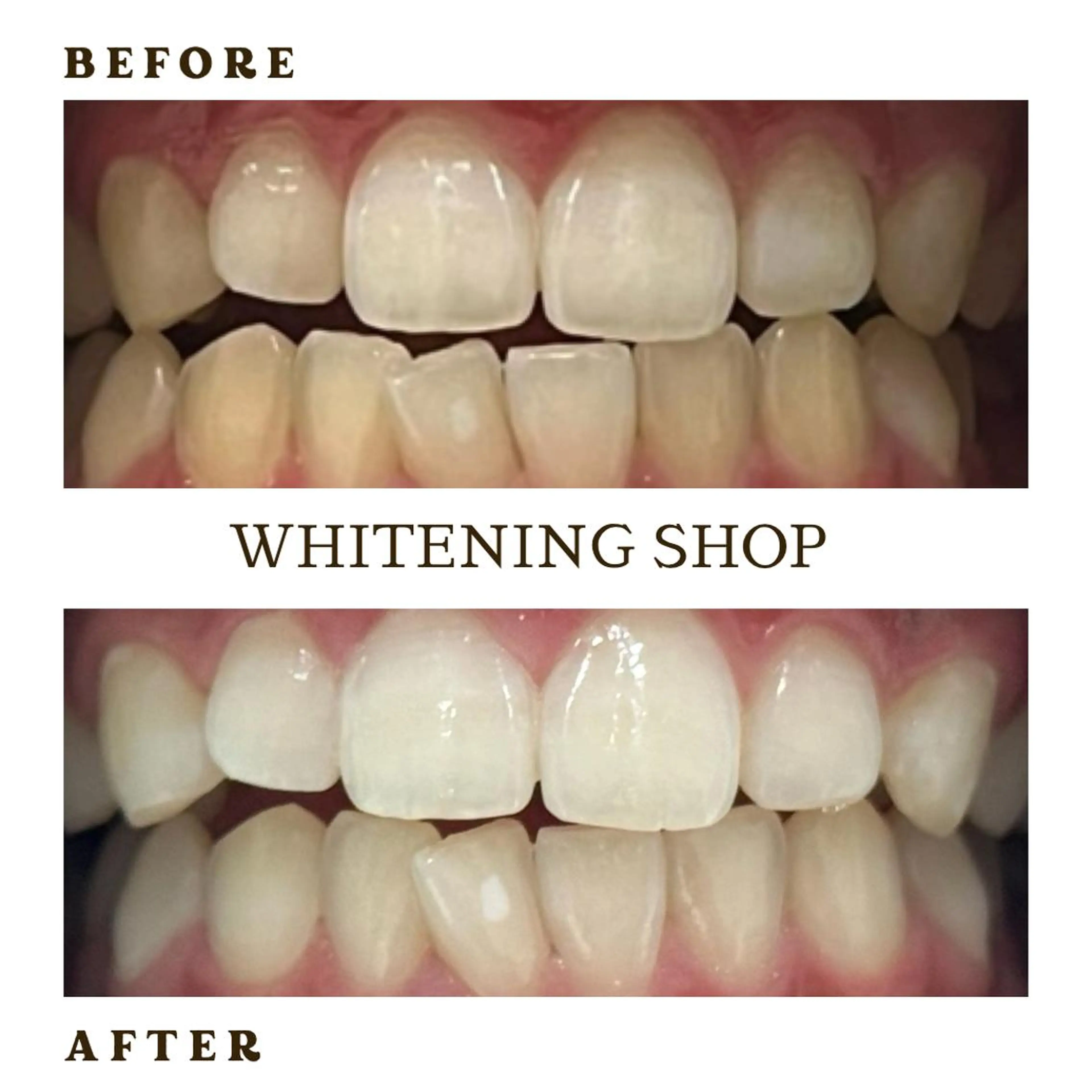 メンズ その他 ホワイトニング ショップ葛西店のその他イメージ