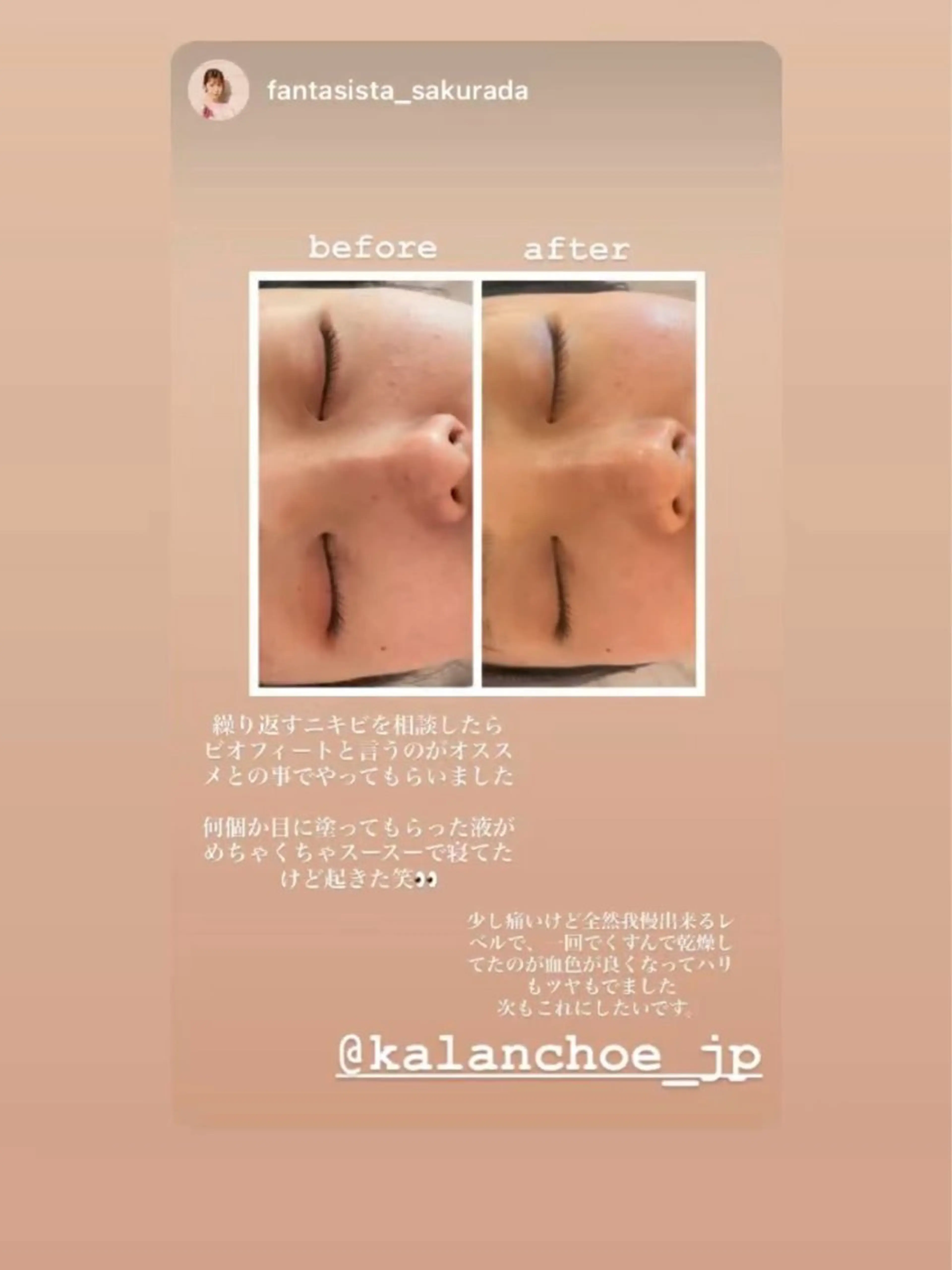 エステ 肌質改善 KALANCHOEのエステ・リラクイメージ