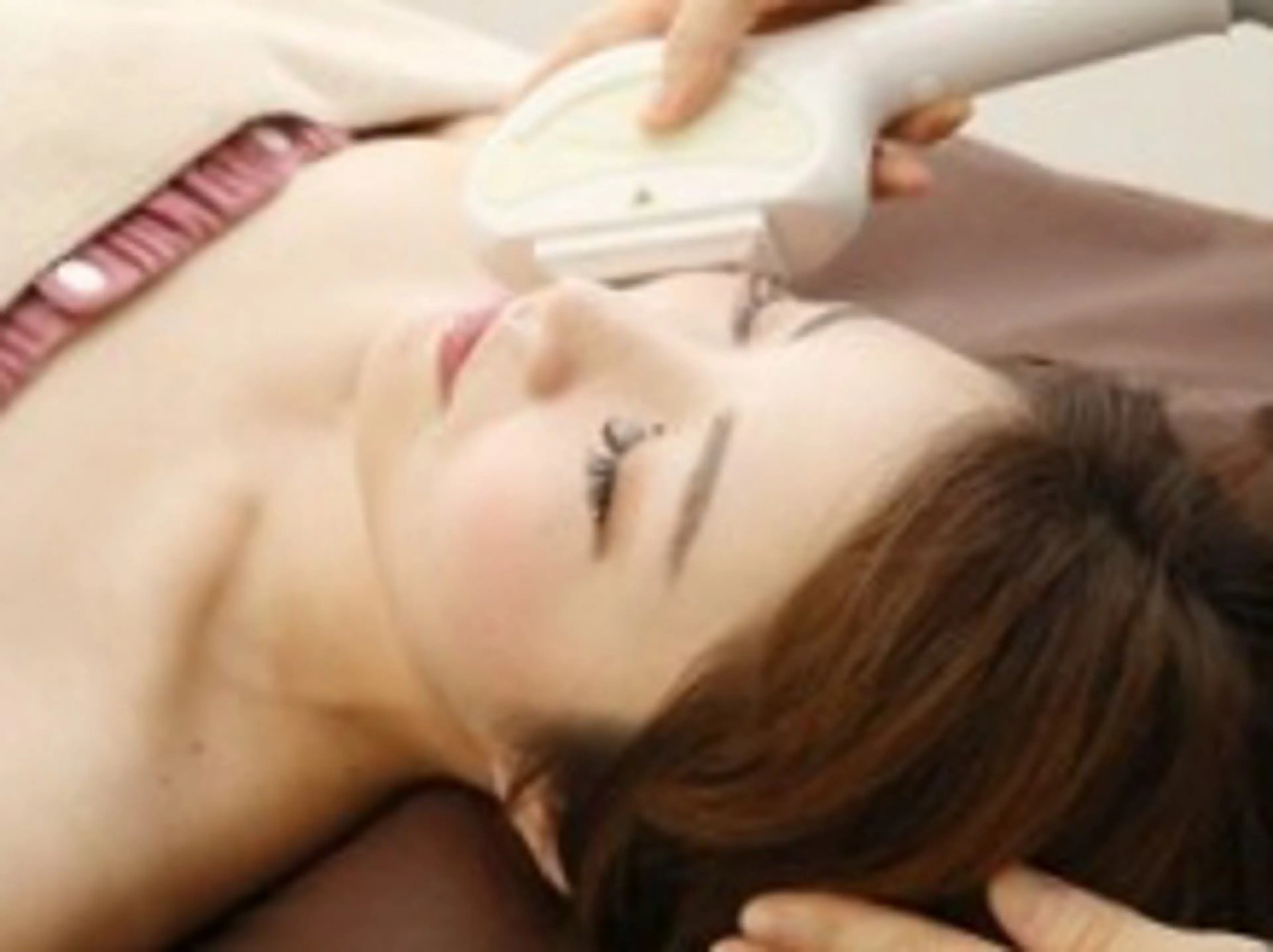 お顔脱毛IPL光フォトの写真