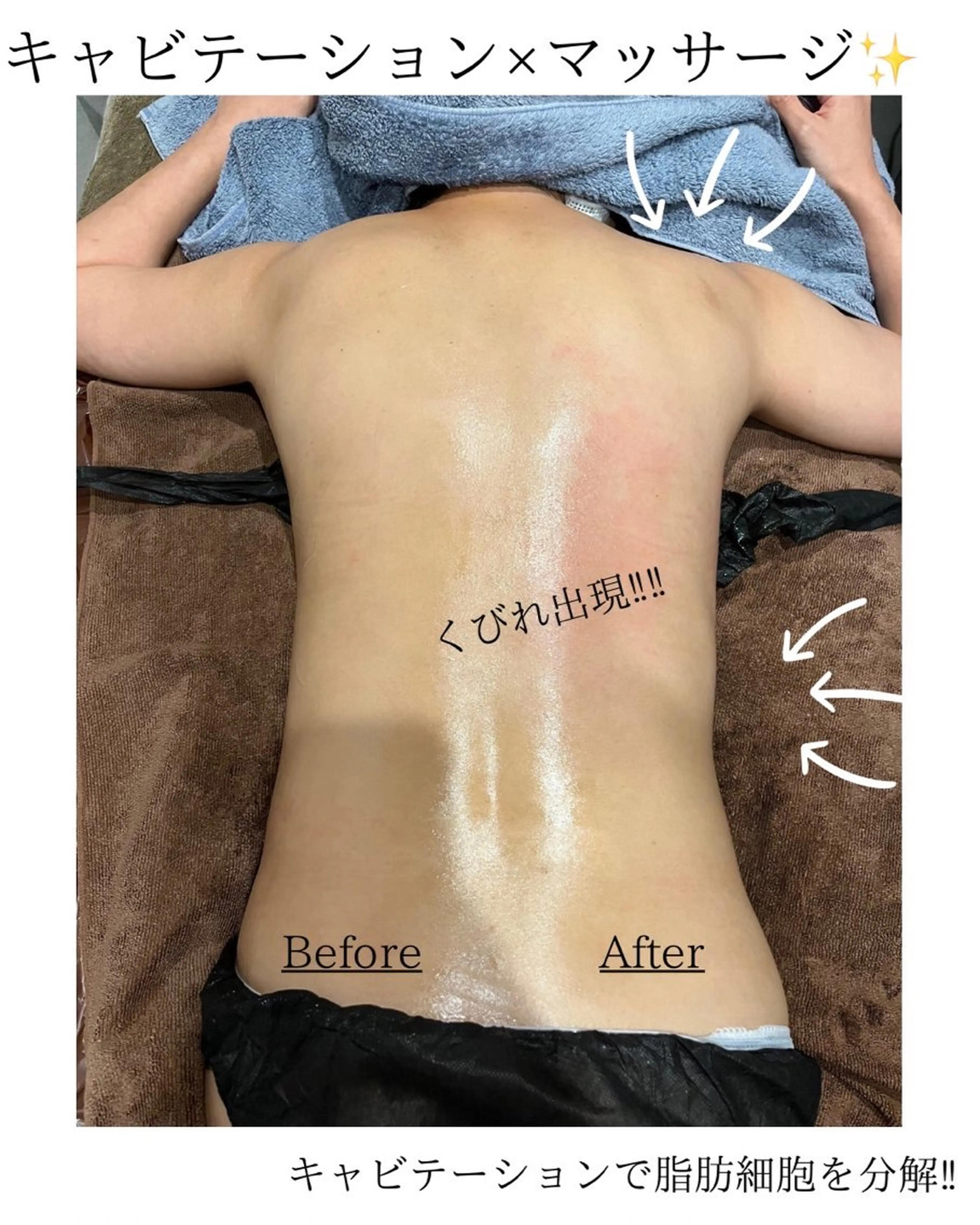 エステ／ネイル/脱毛 R.Msalonのネイルデザイン