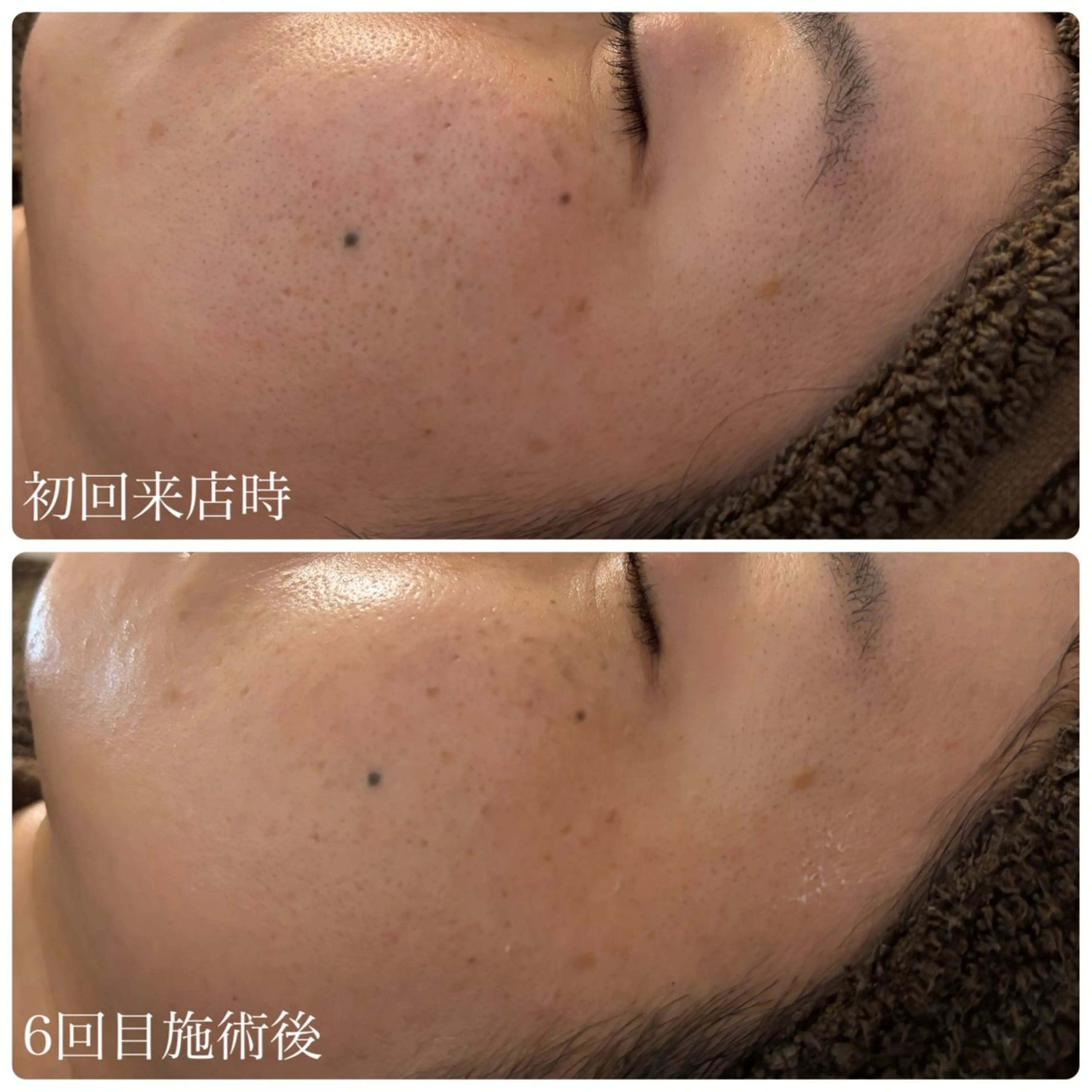 肌管理サロン Briller所属・肌管理サロン Briller 押上のエステ・リラクイメージ